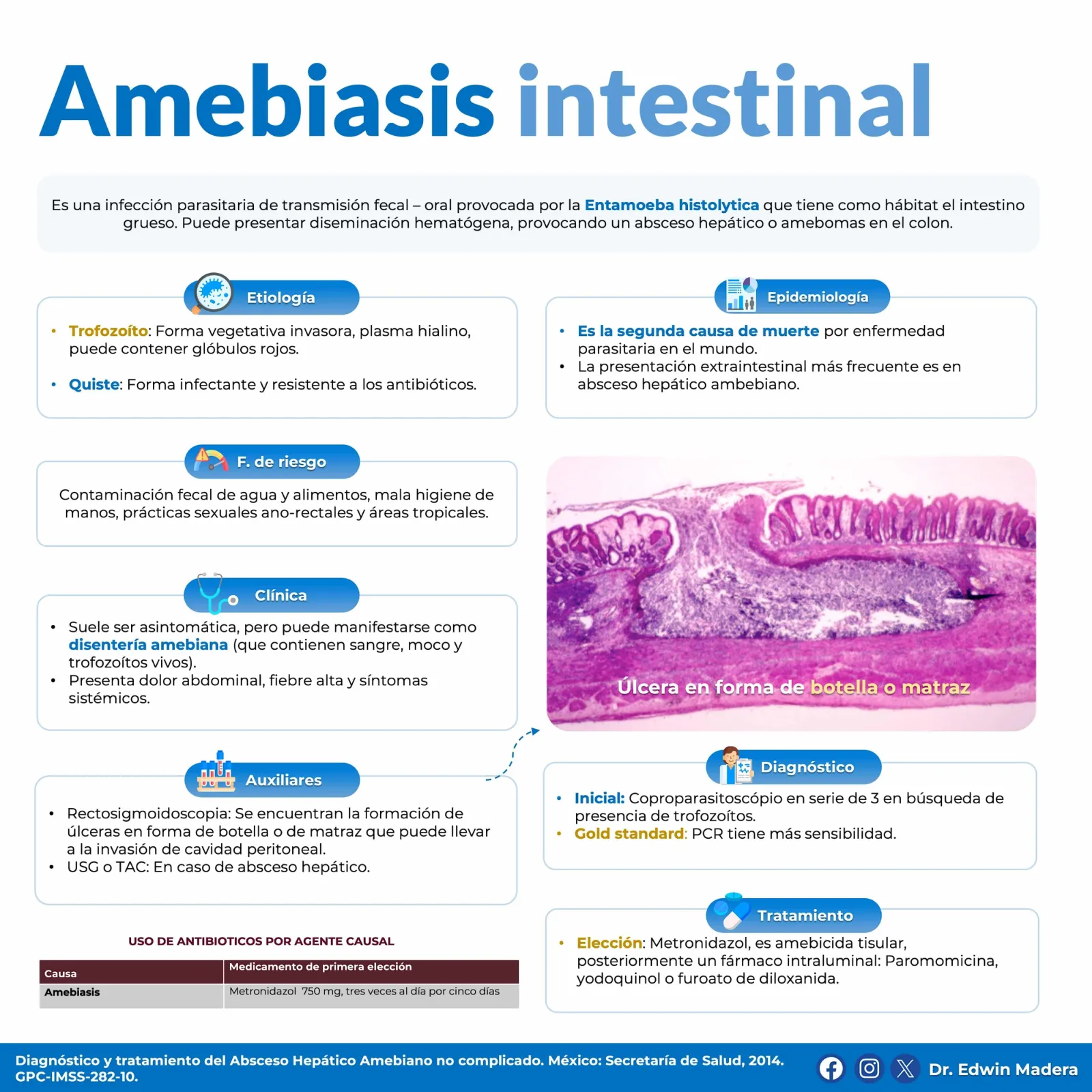 Amebiasis intestinal
