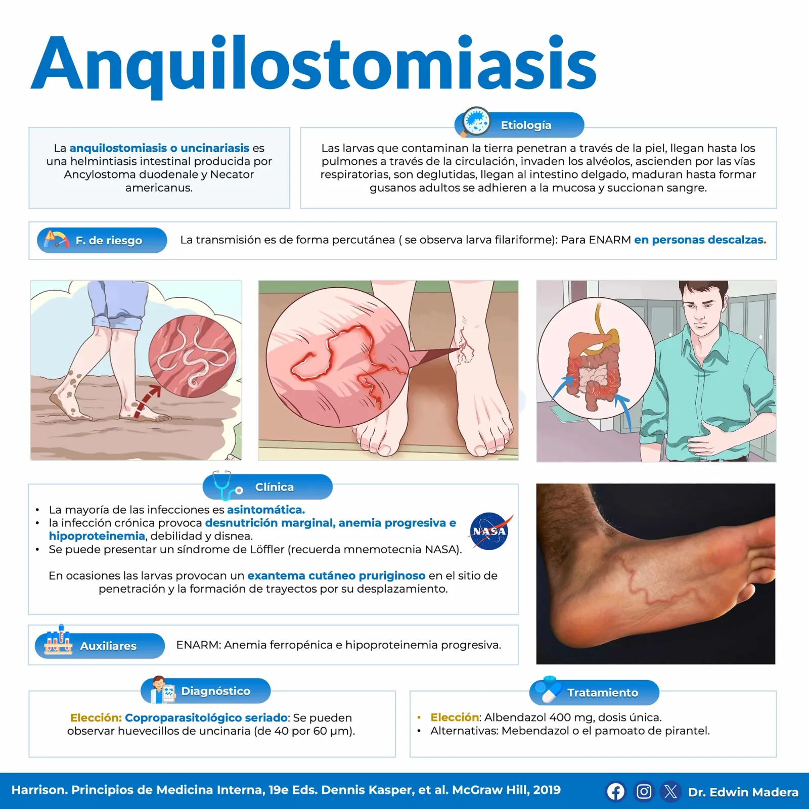 Anquilostomiasis