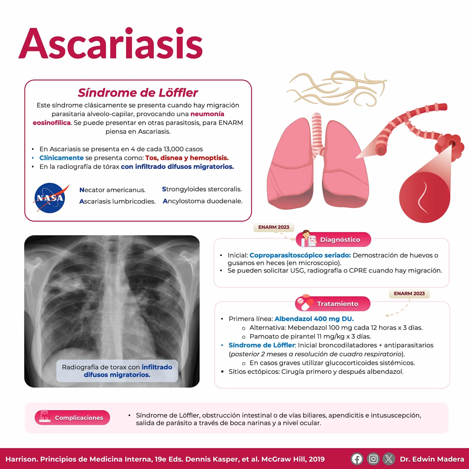 Ascariasis