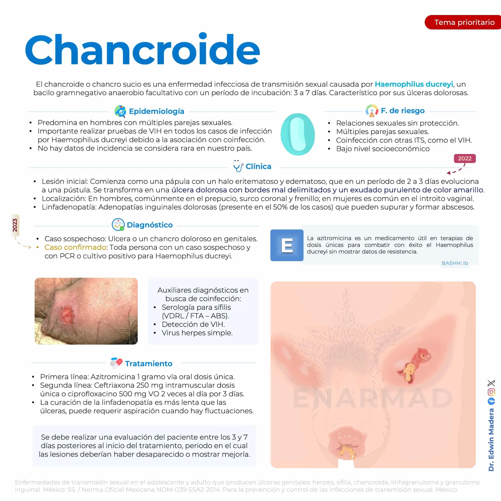 Chancroide