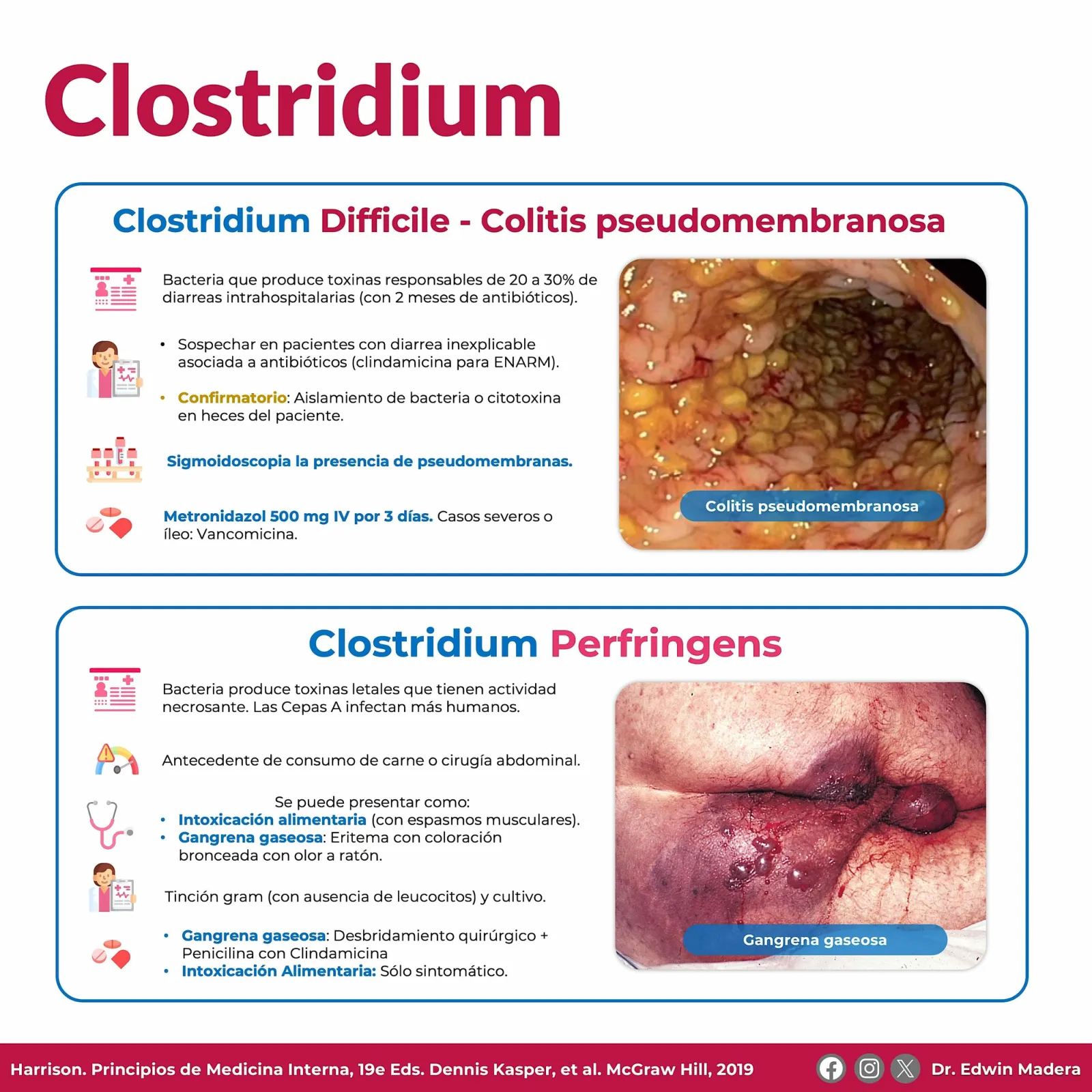 Clostridium