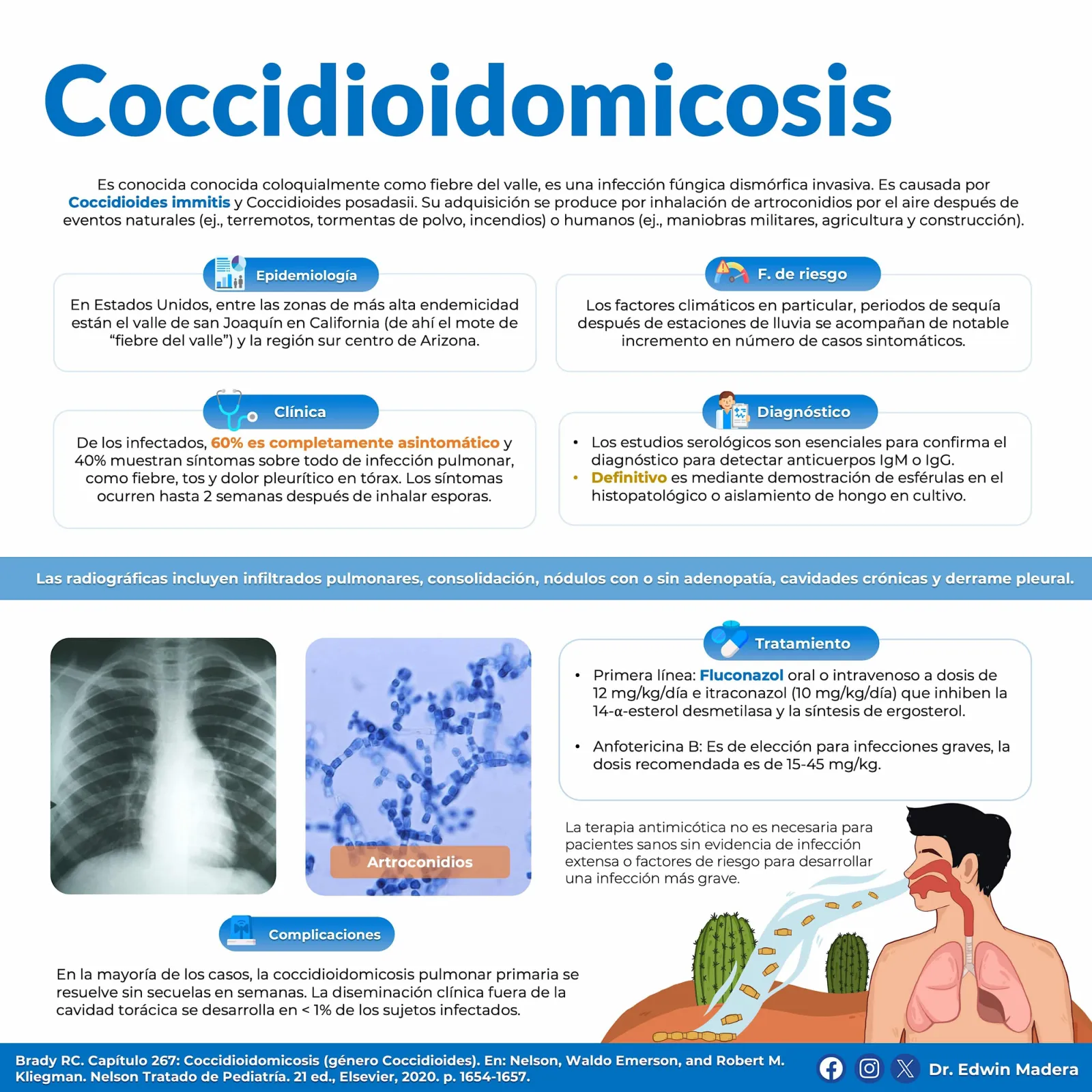 Coccidioidomicosis