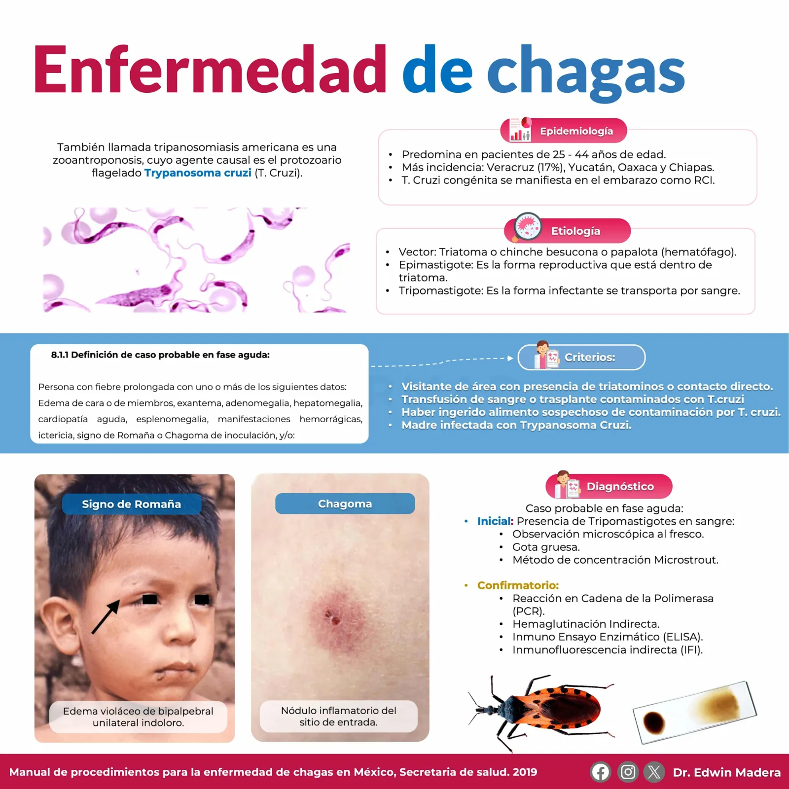 Enfermedad de Chagas