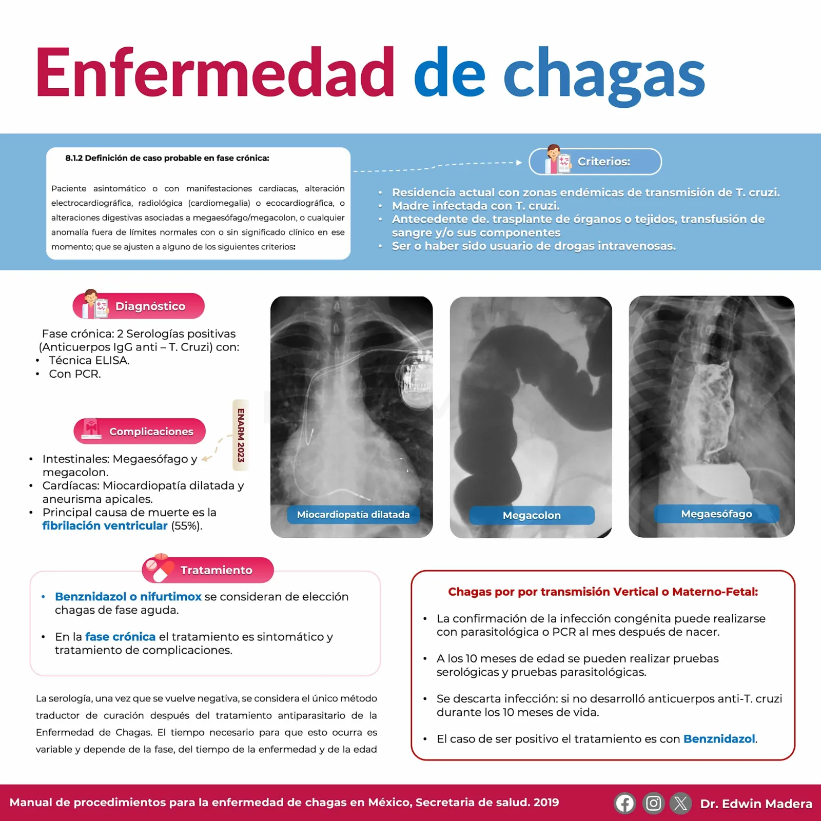 Enfermedad de Chagas