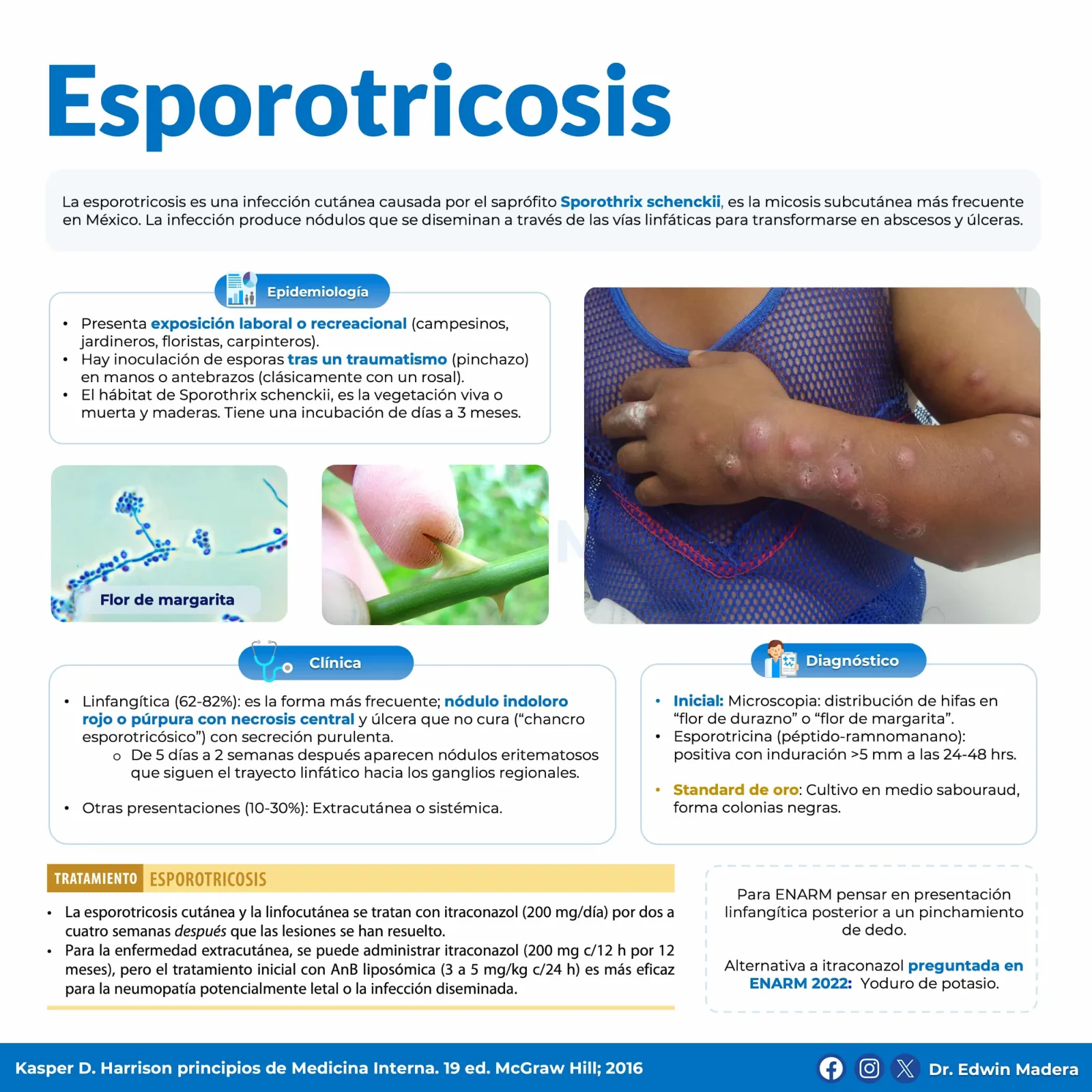 Esporotricosis