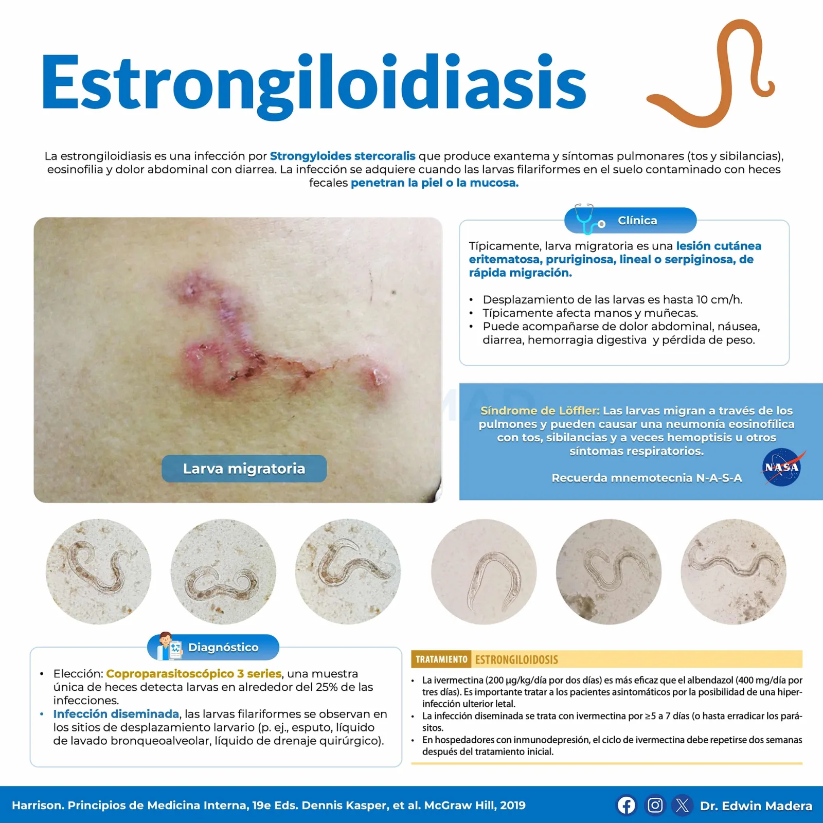 Estrongiloidiasis