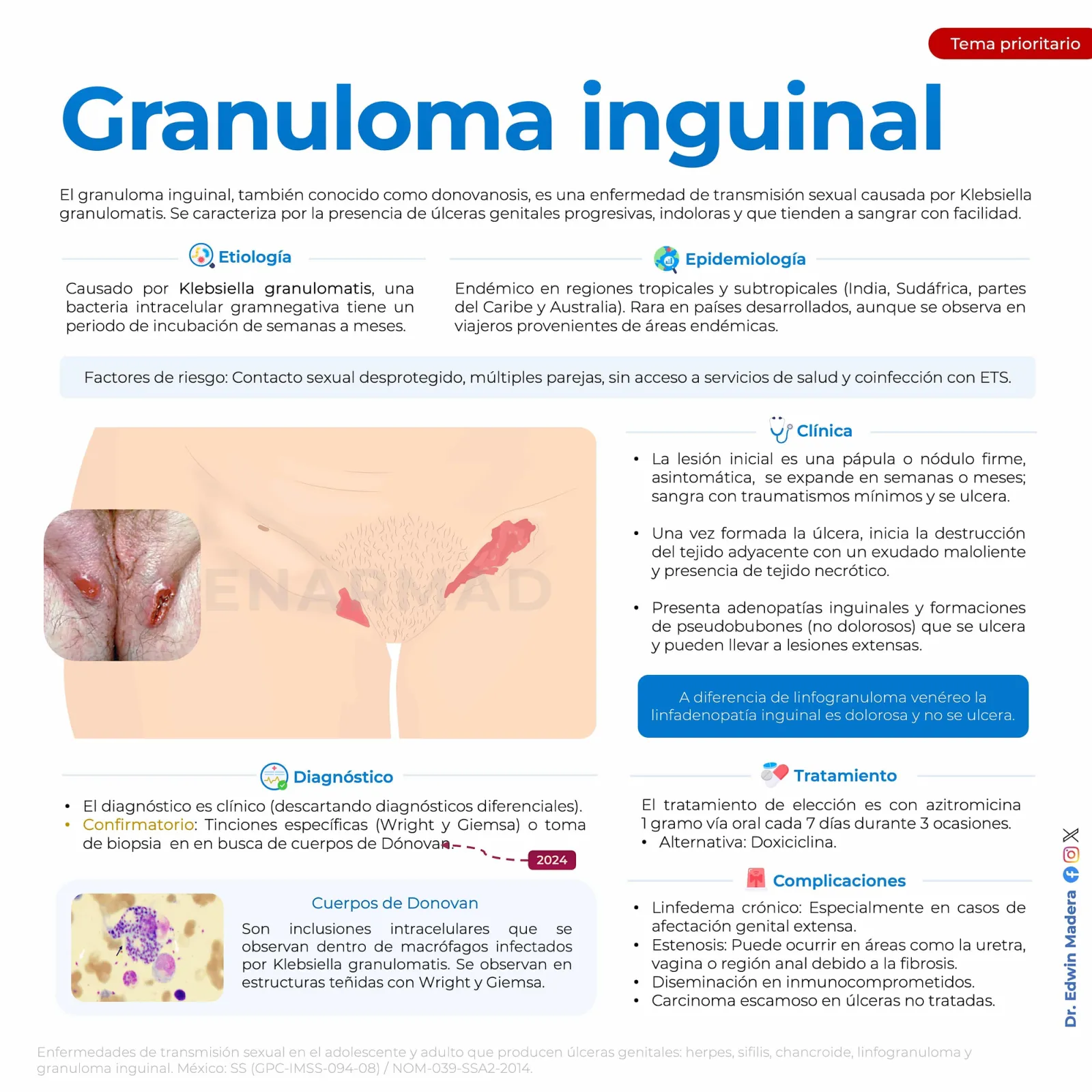 Granuloma inguinal