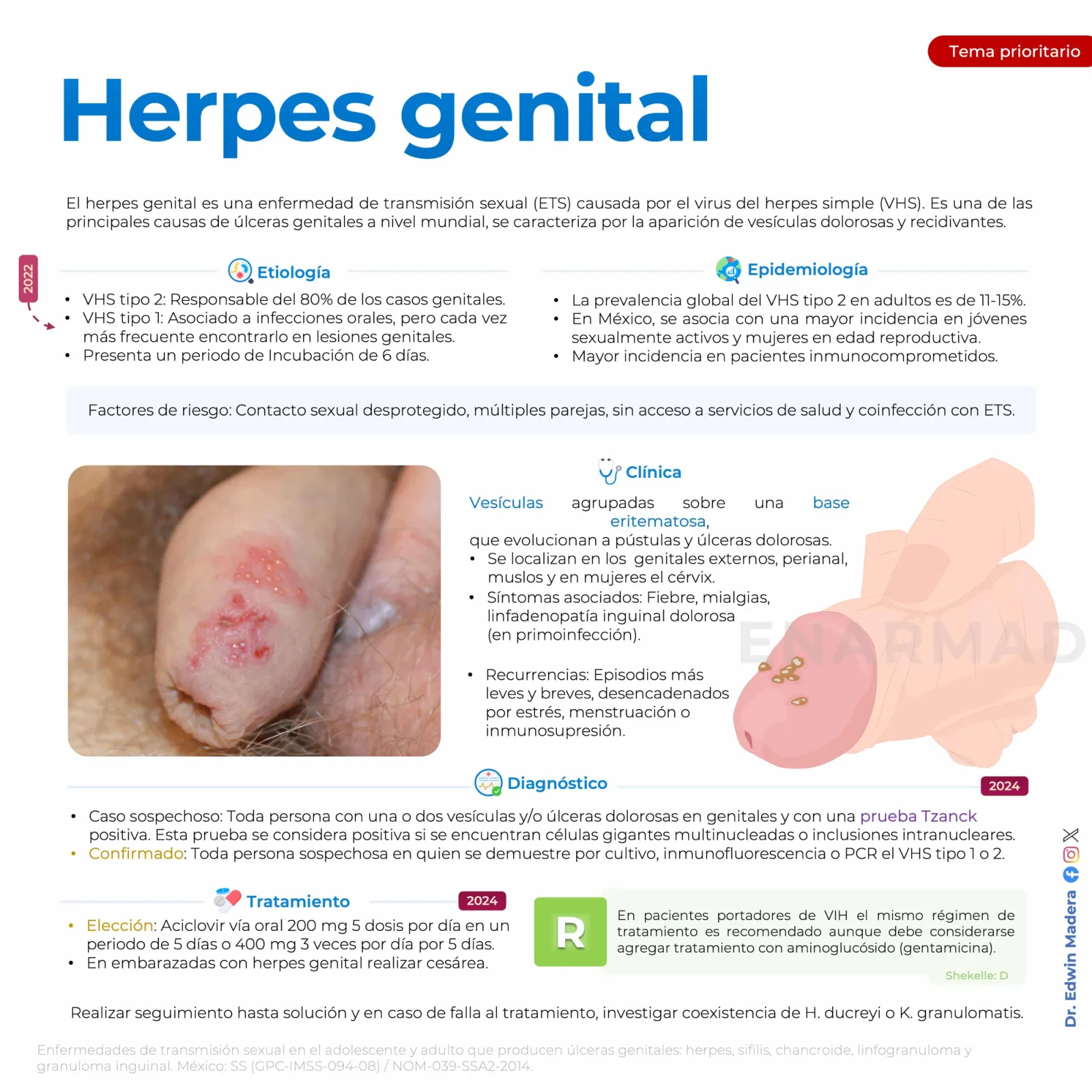 Herpes genital