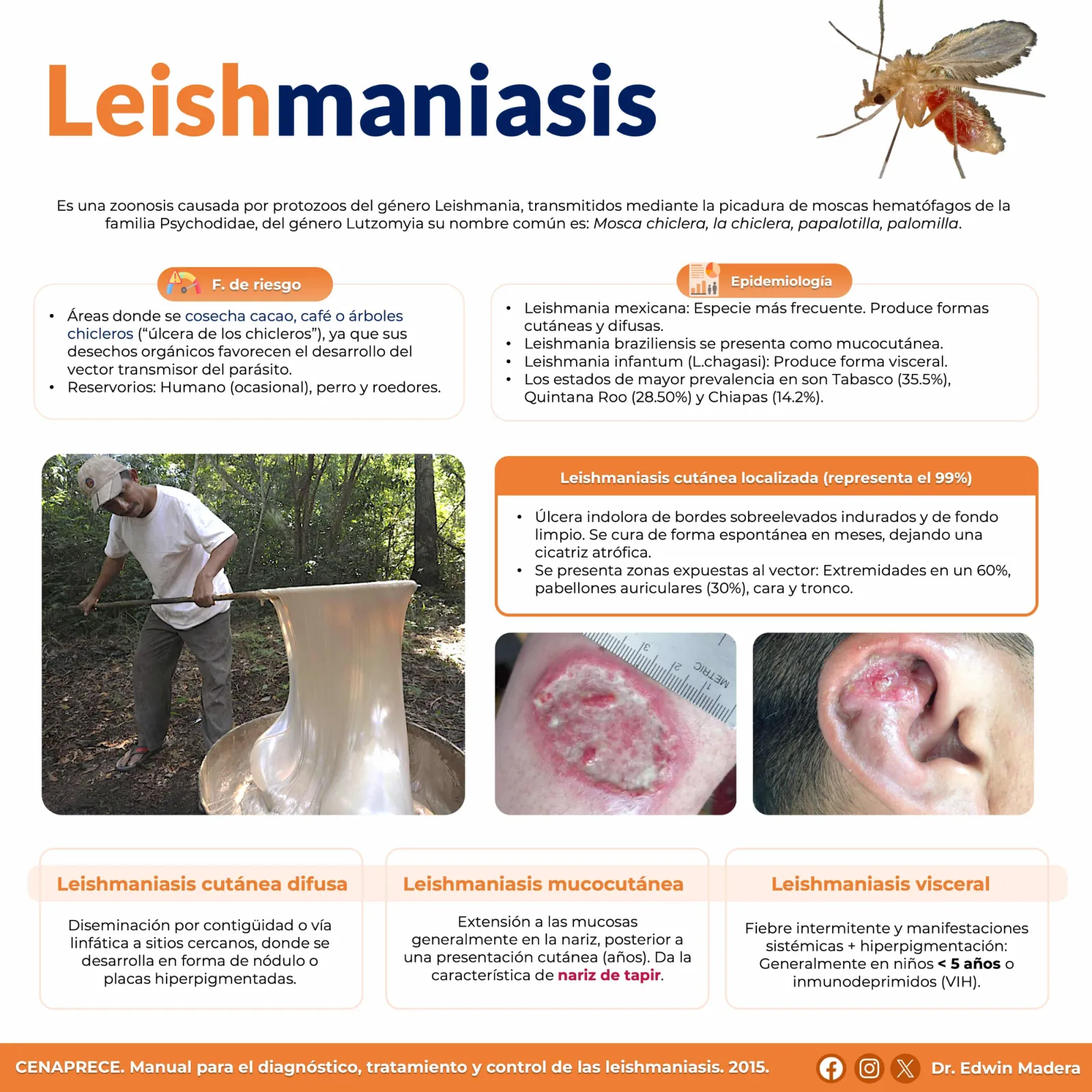 Leishmaniasis