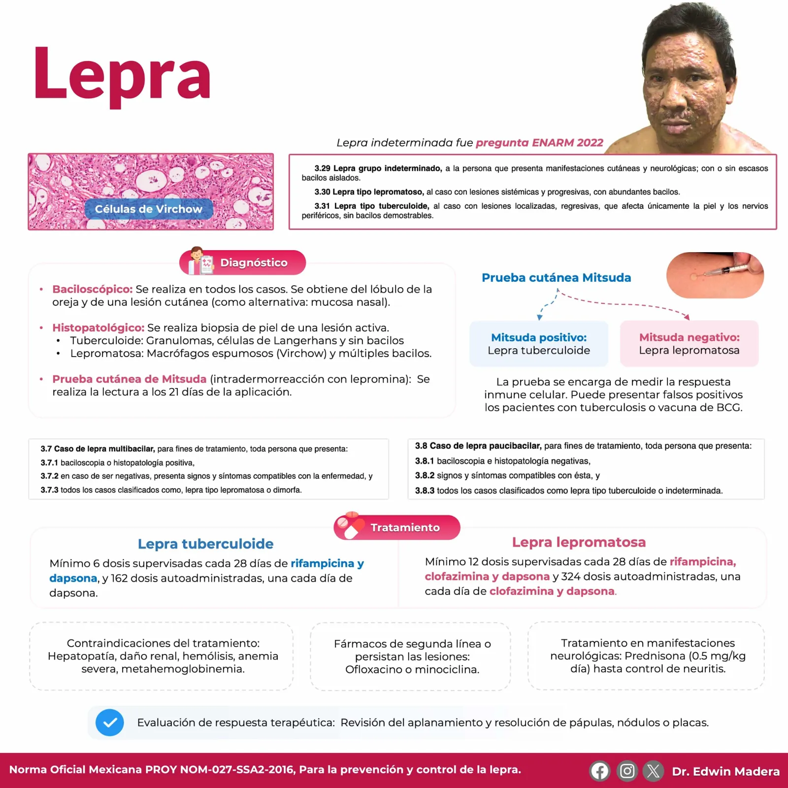Lepra