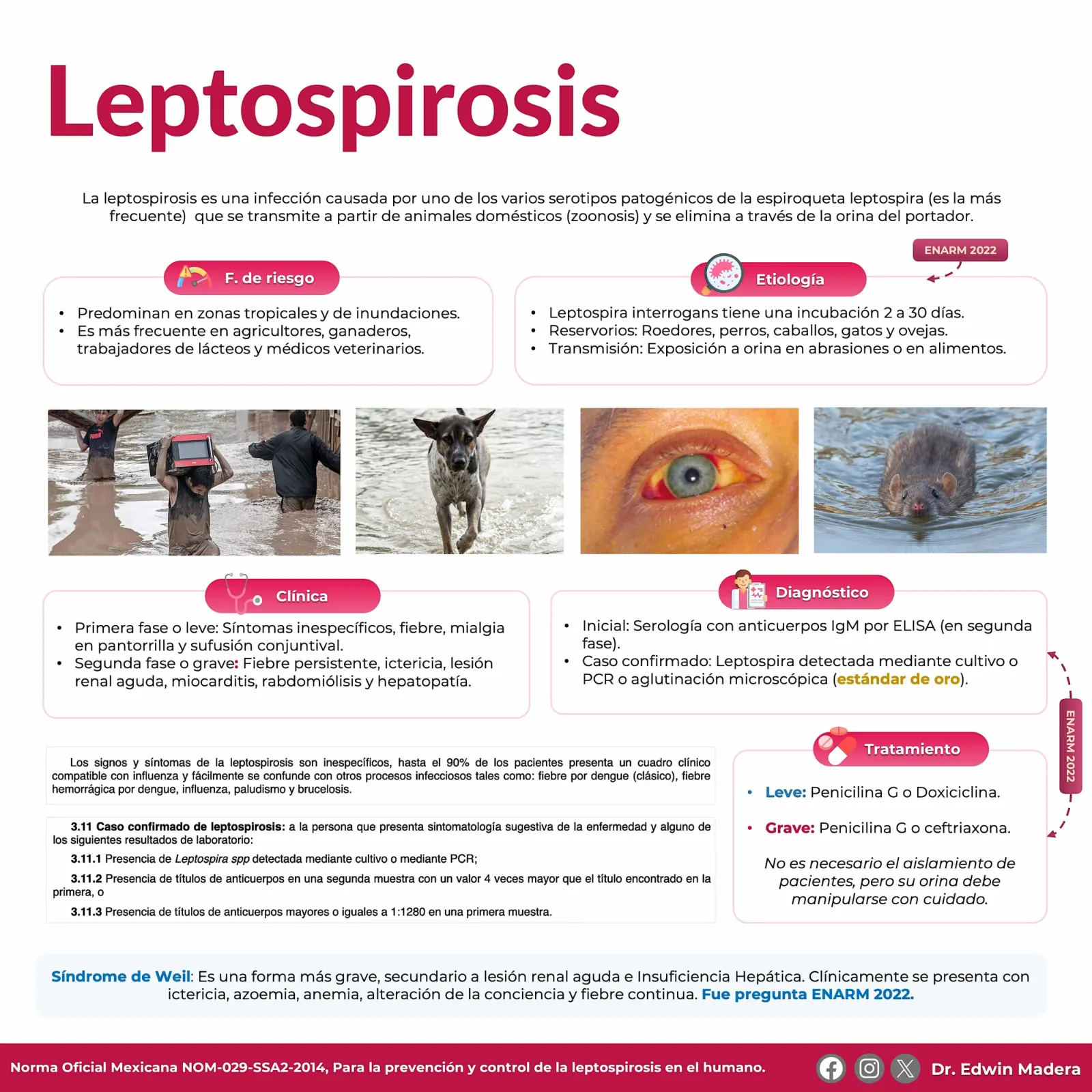 Leptospirosis