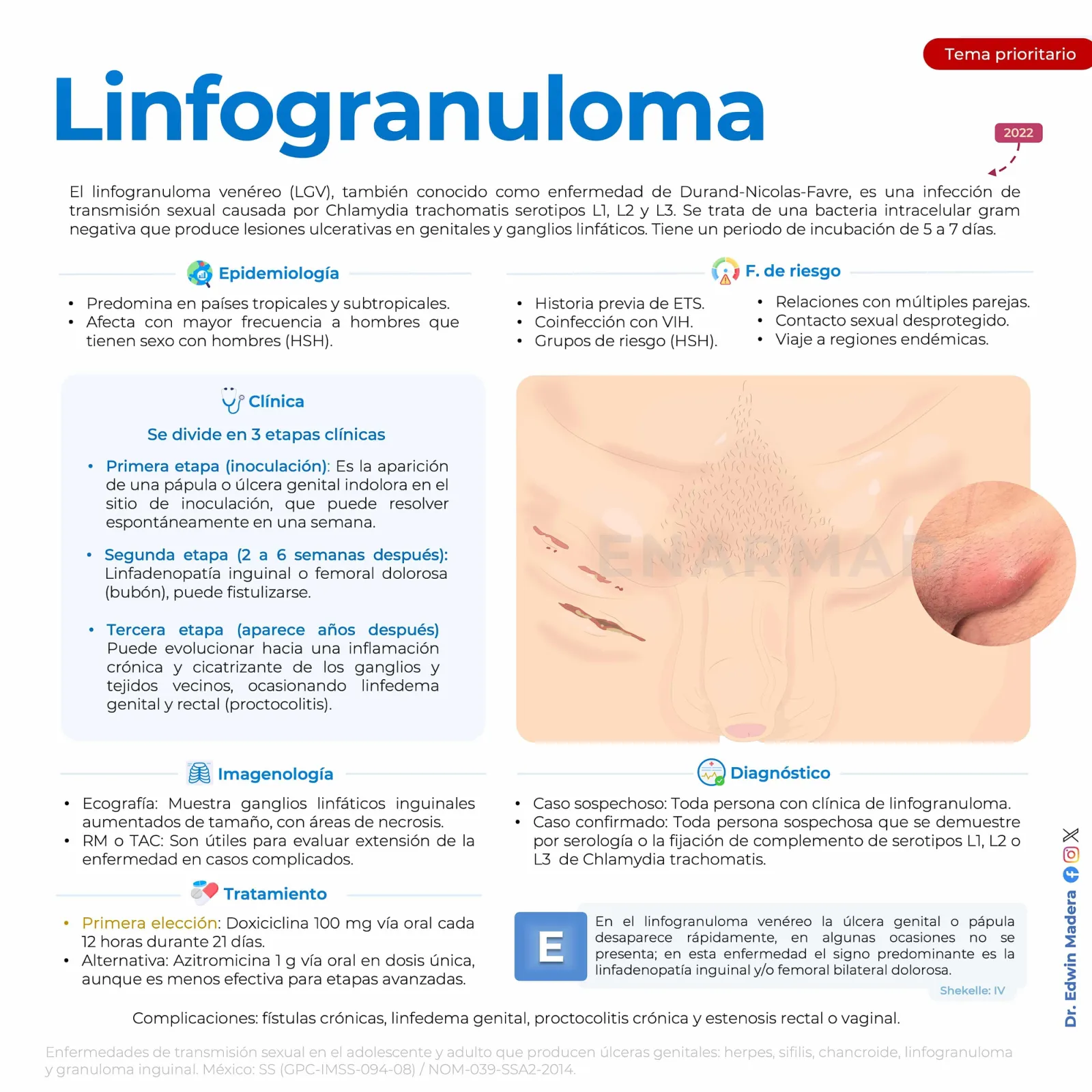 Linfogranuloma