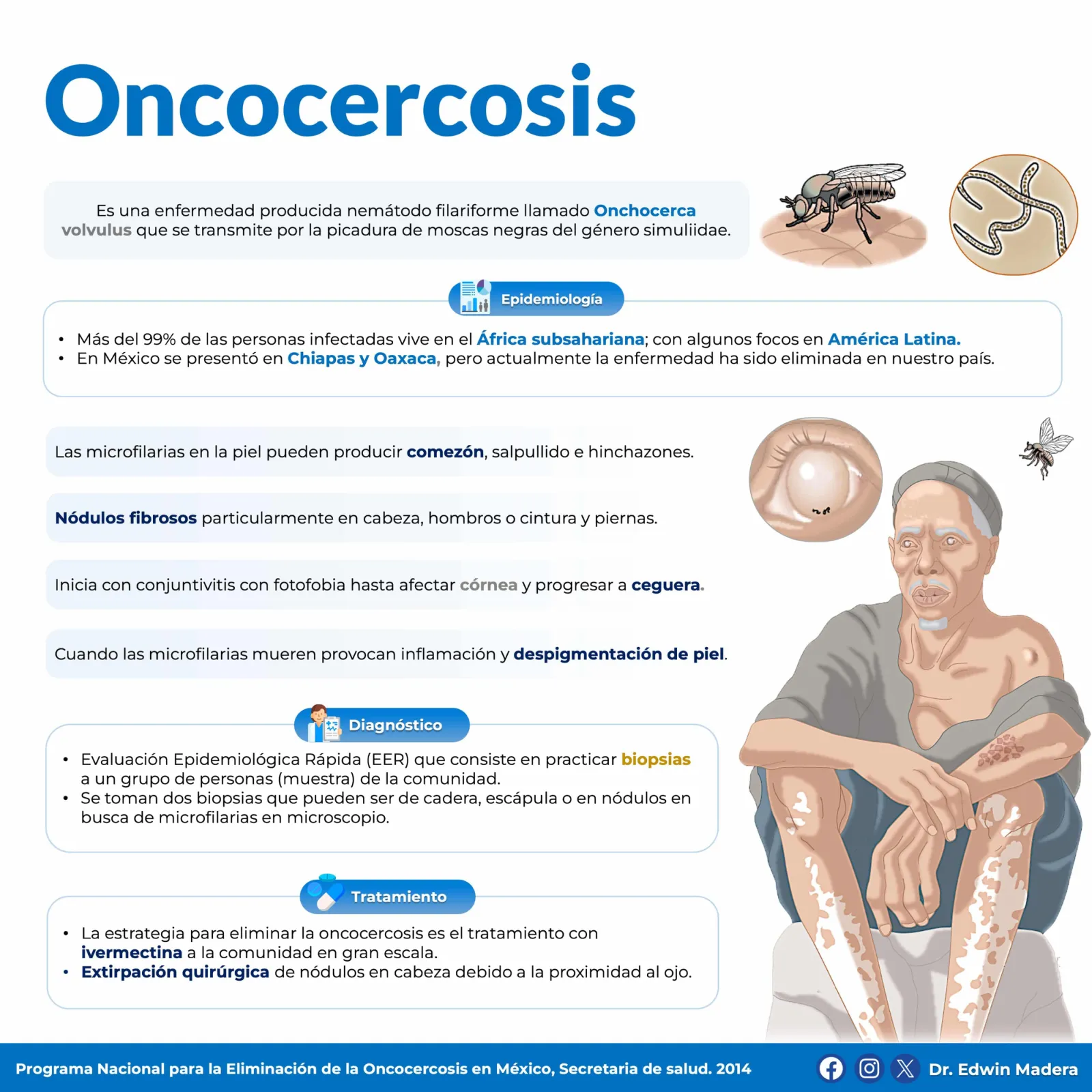 Oncocercosis