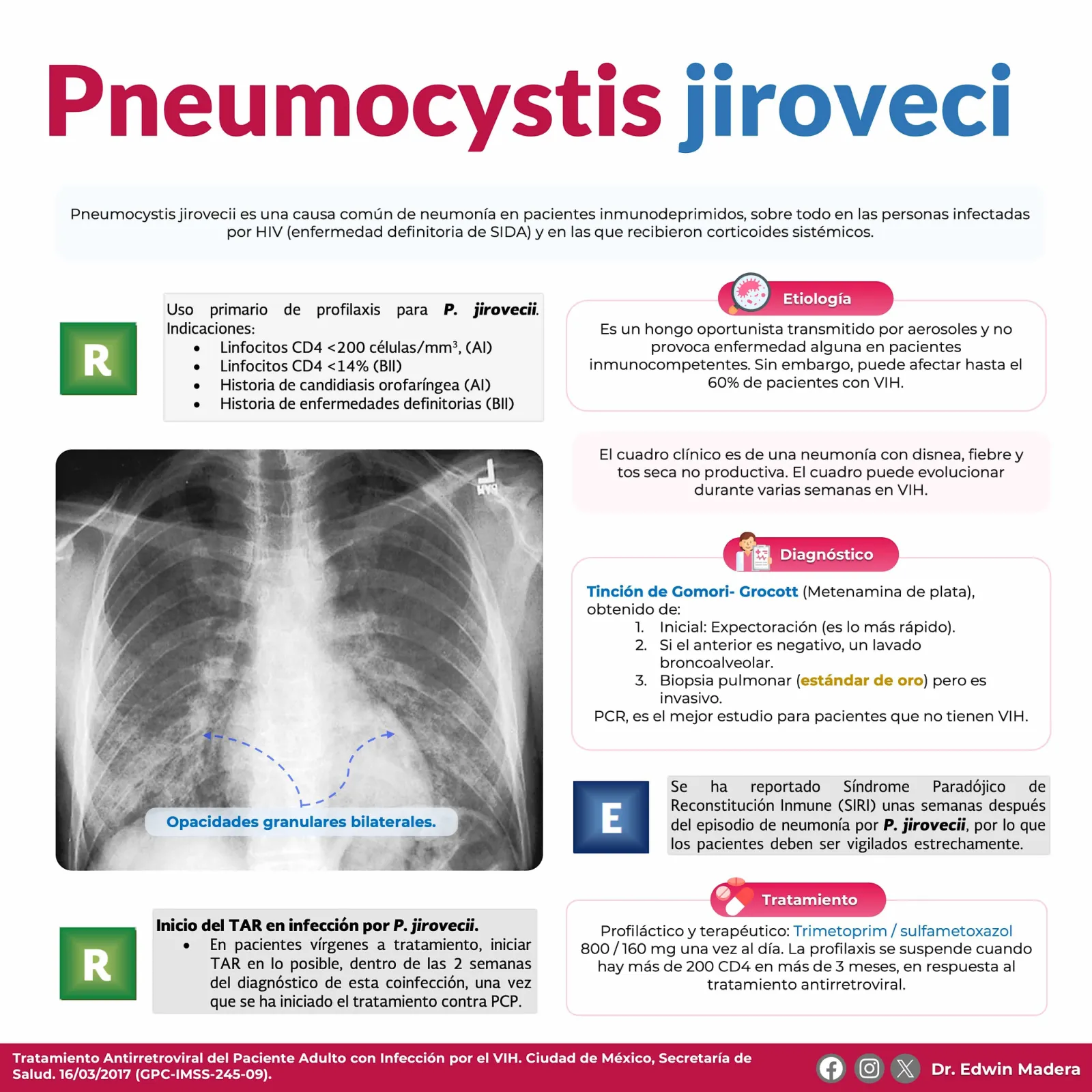 Pneumocystis jiroveci