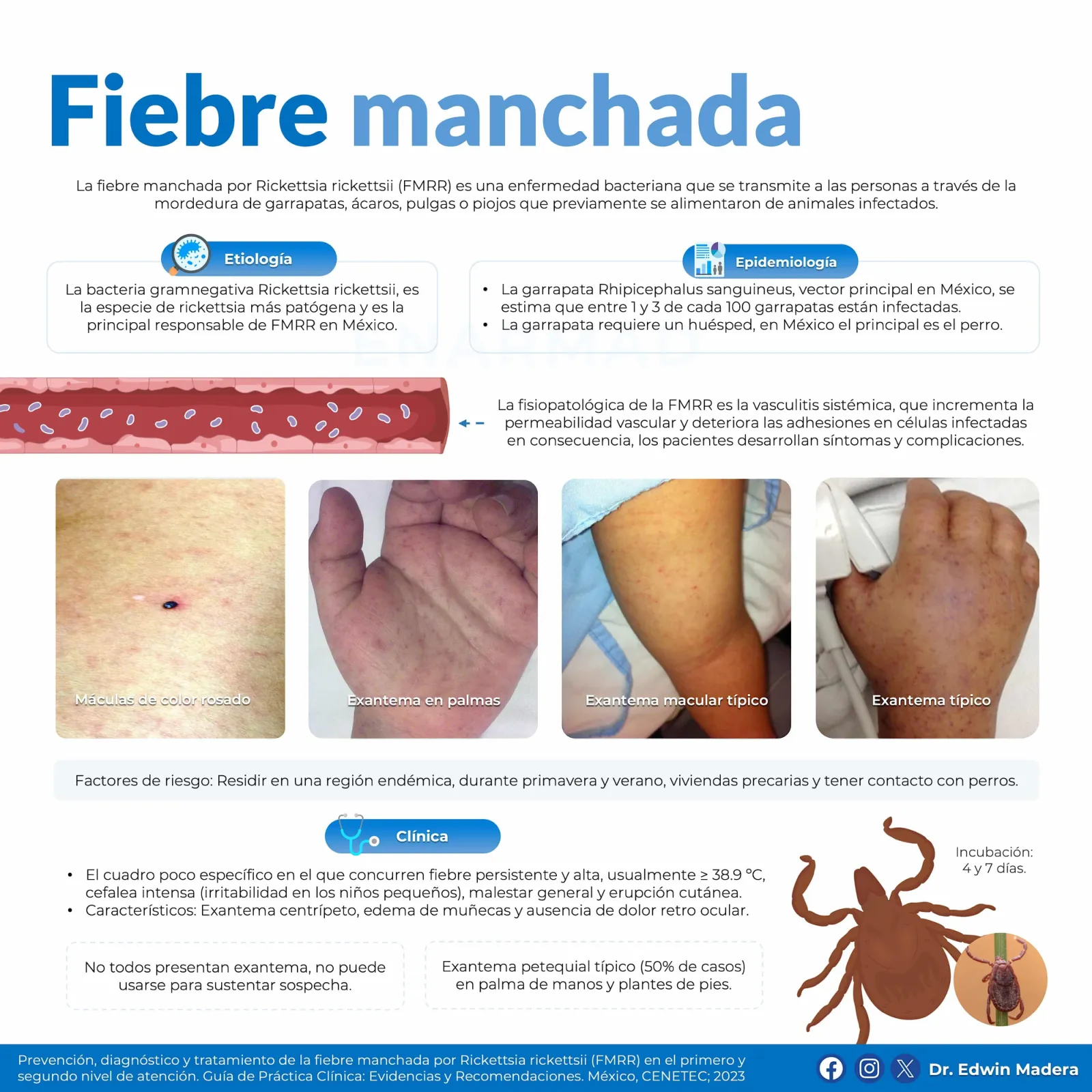 Rickettsiosis Fiebre manchada