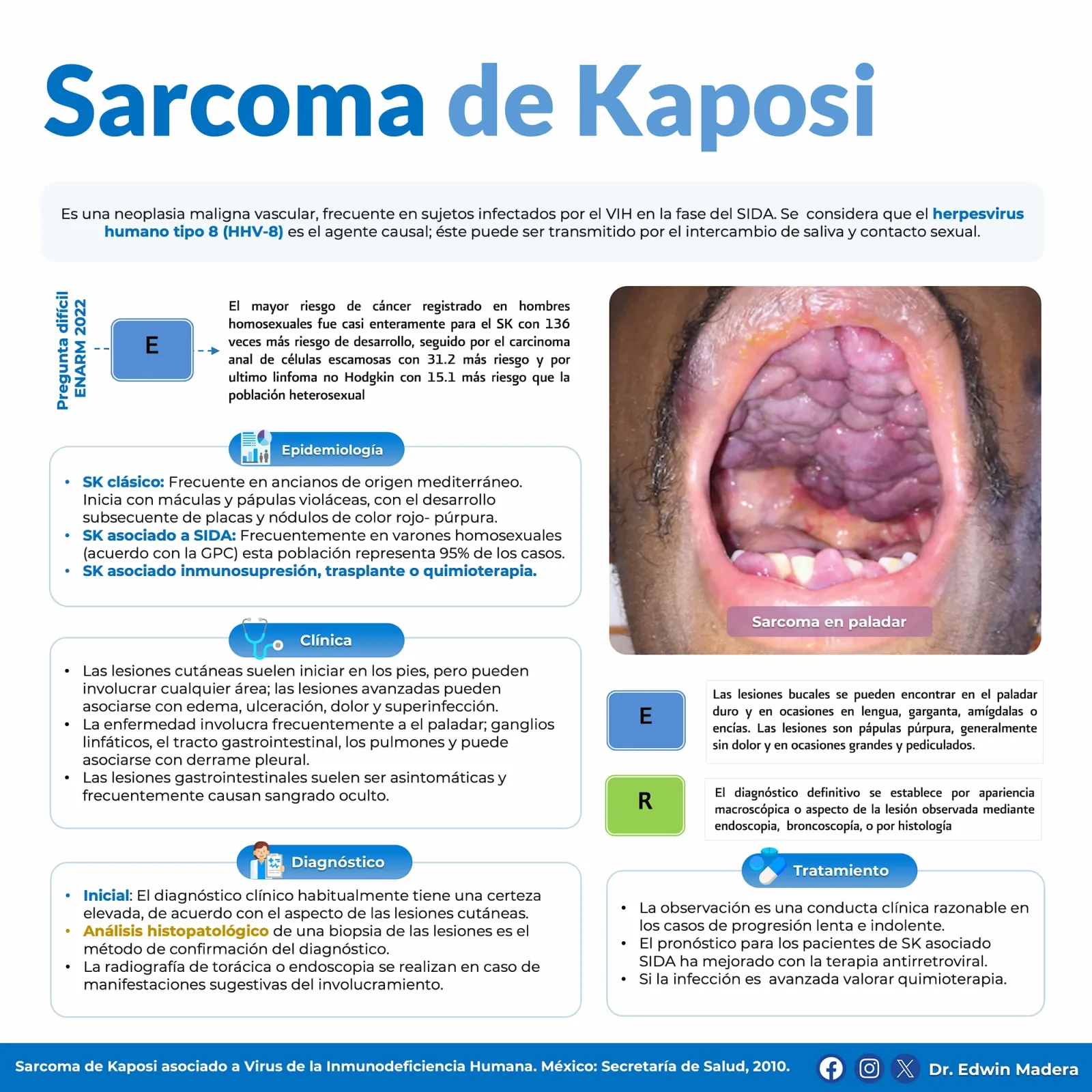 Sarcoma de Kaposi