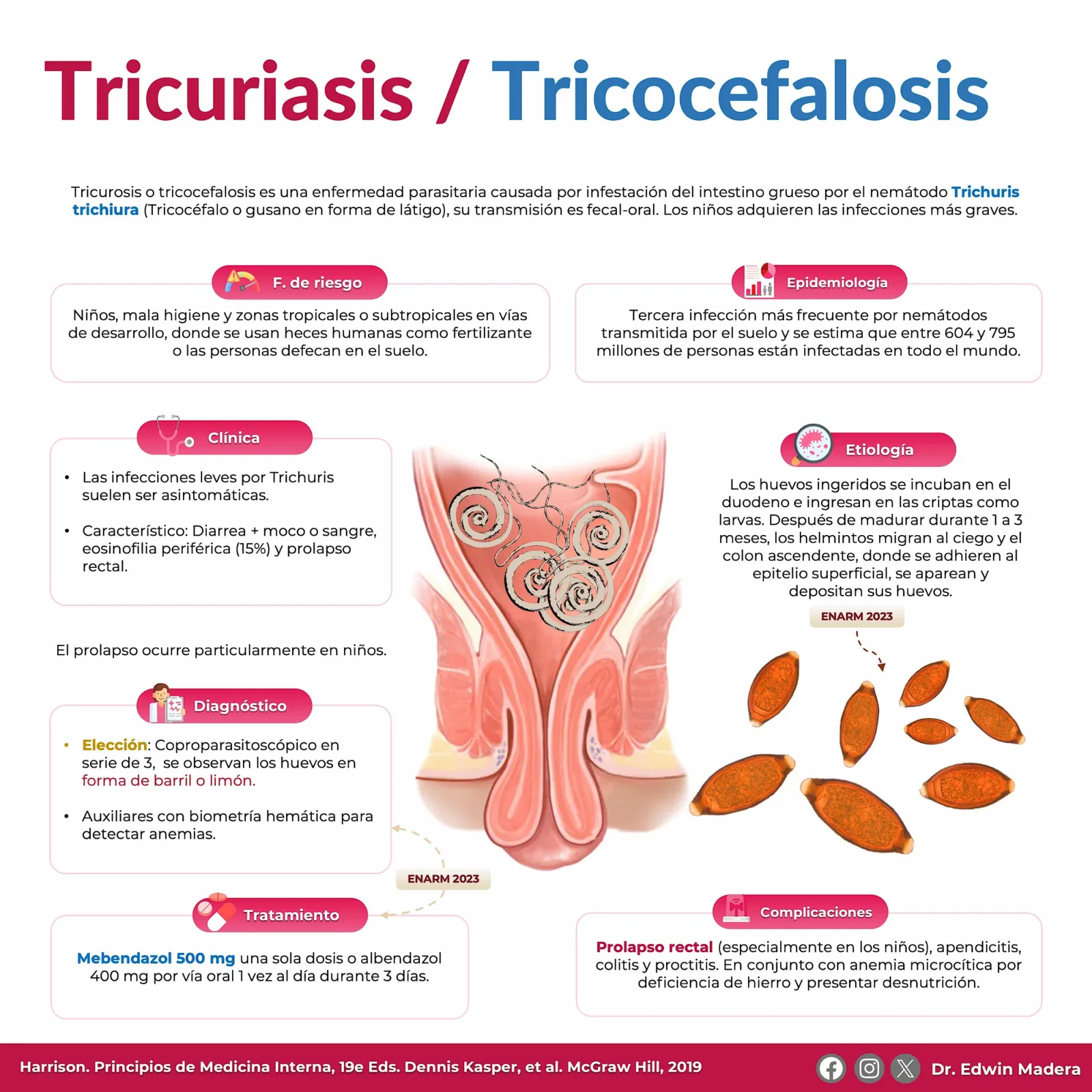 Tricuriasis