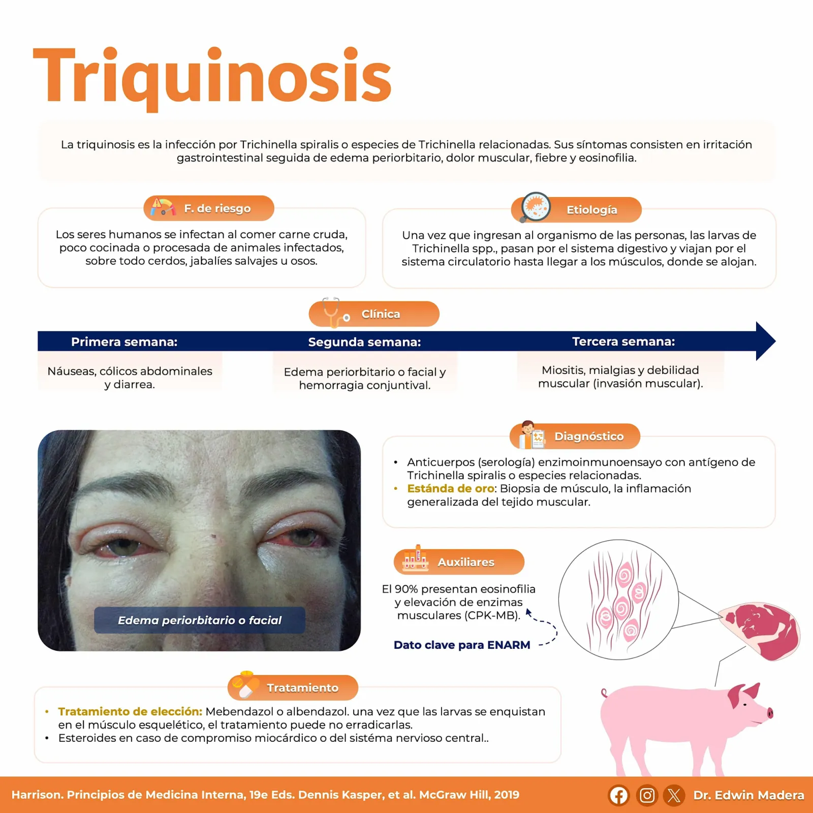 Triquinosis
