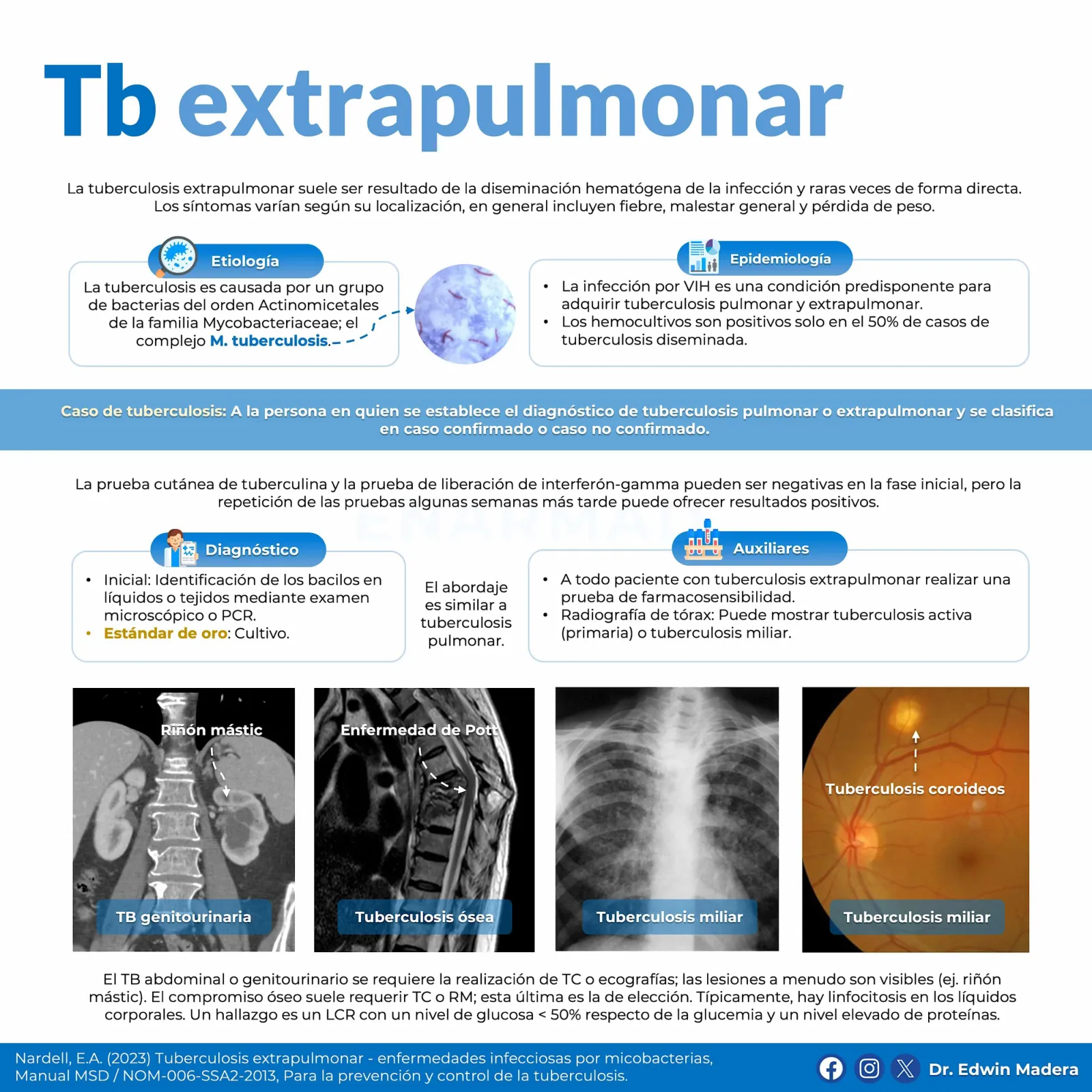 Tuberculosis extrapulmonar