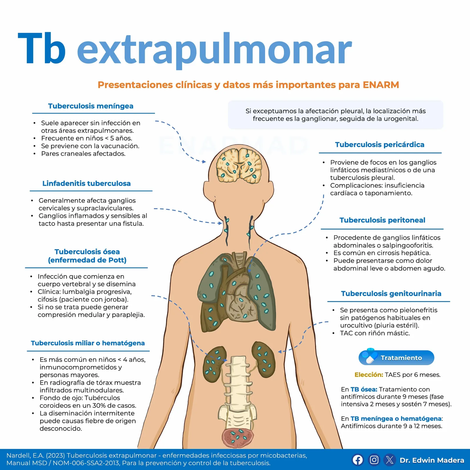 Tuberculosis extrapulmonar