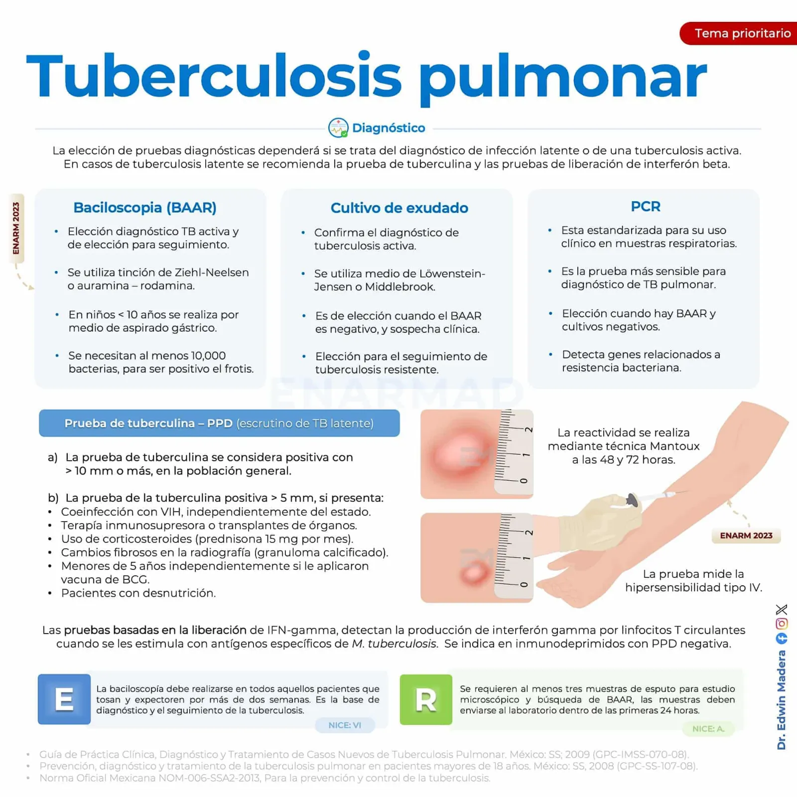 Tuberculosis pulmonar