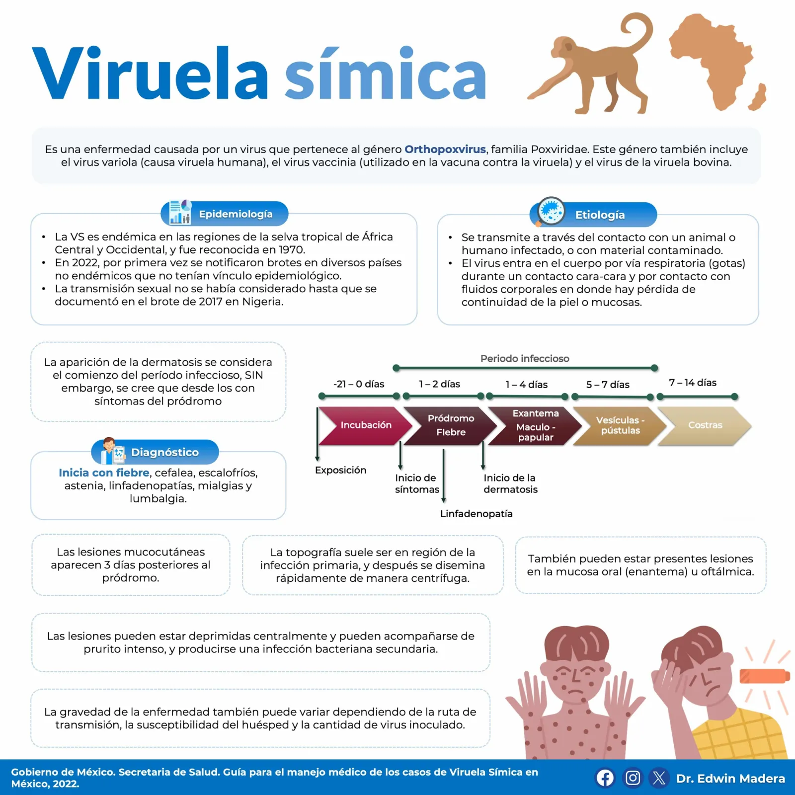Viruela símica