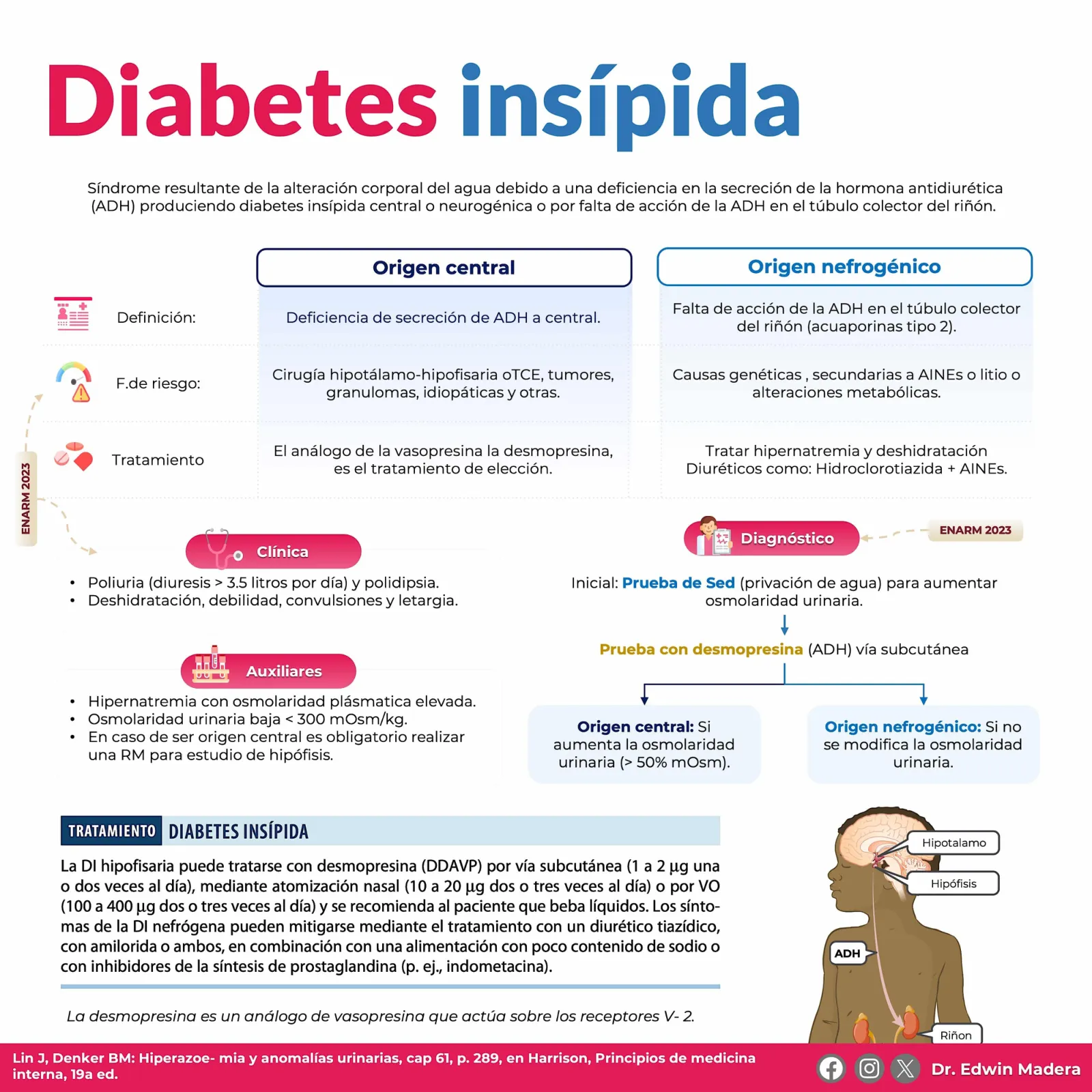 Diabetes insípida