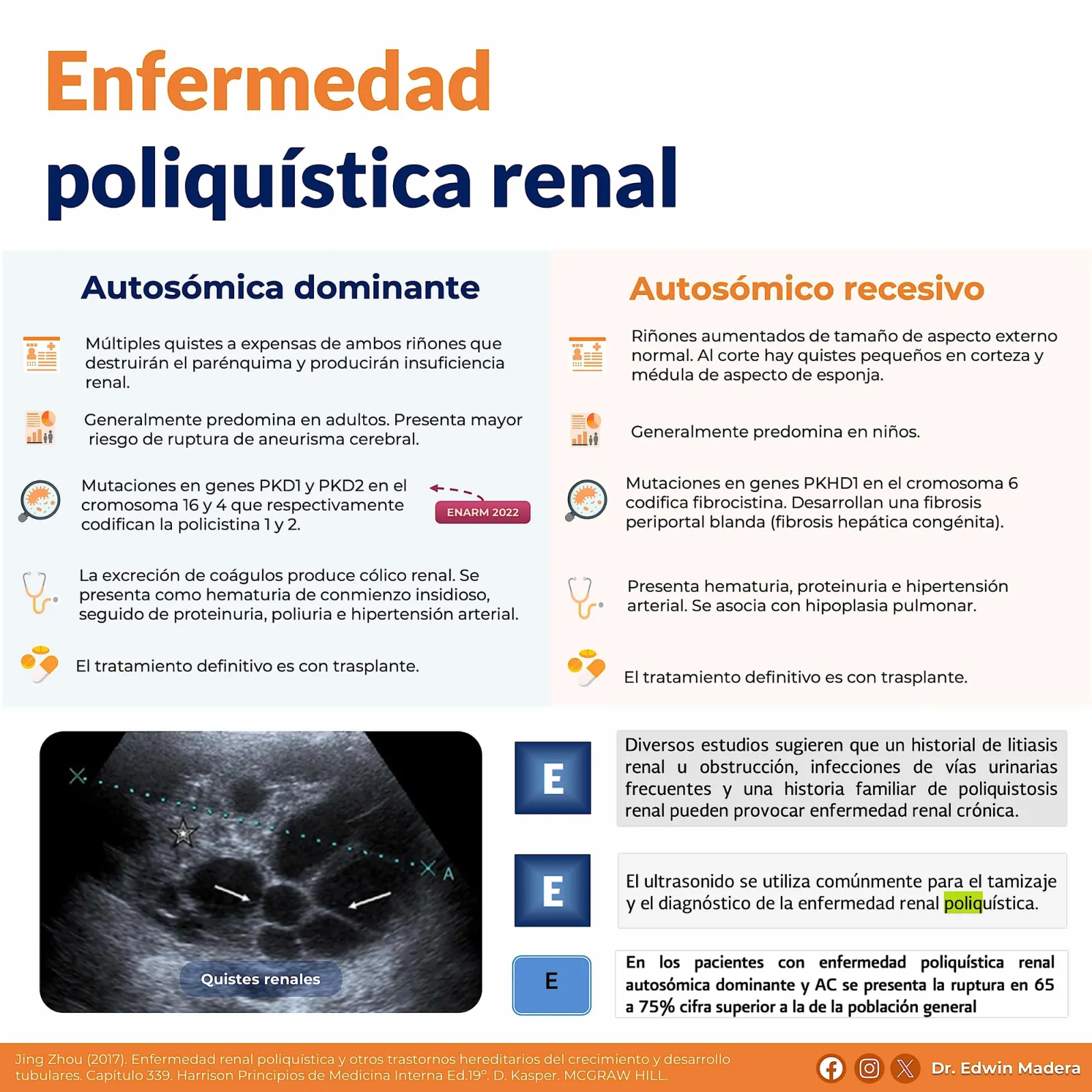 Enfermedad poliquística renal