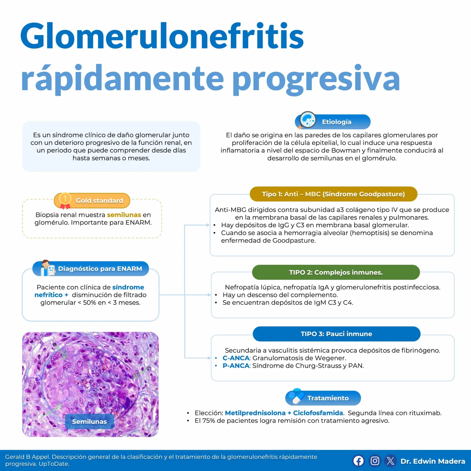 Glomerulonefritis rápidamente progresiva
