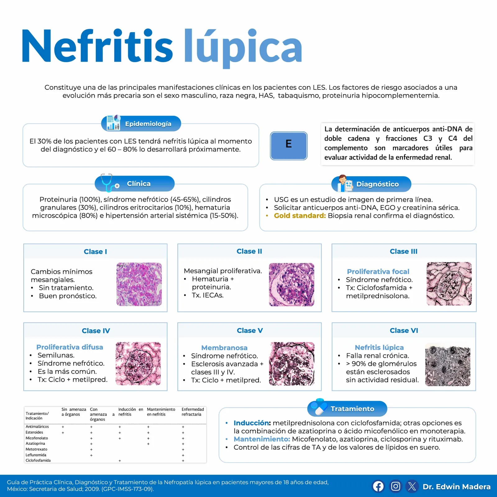 Nefritis lúpica