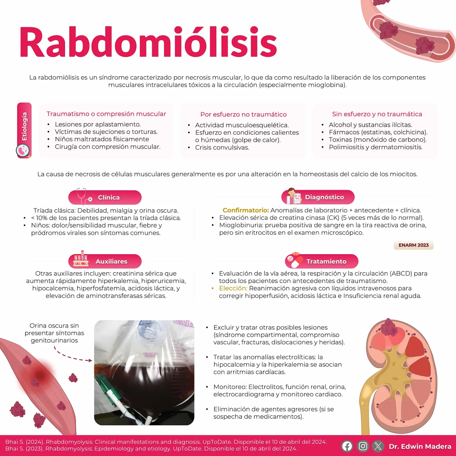 Rabdomiólisis