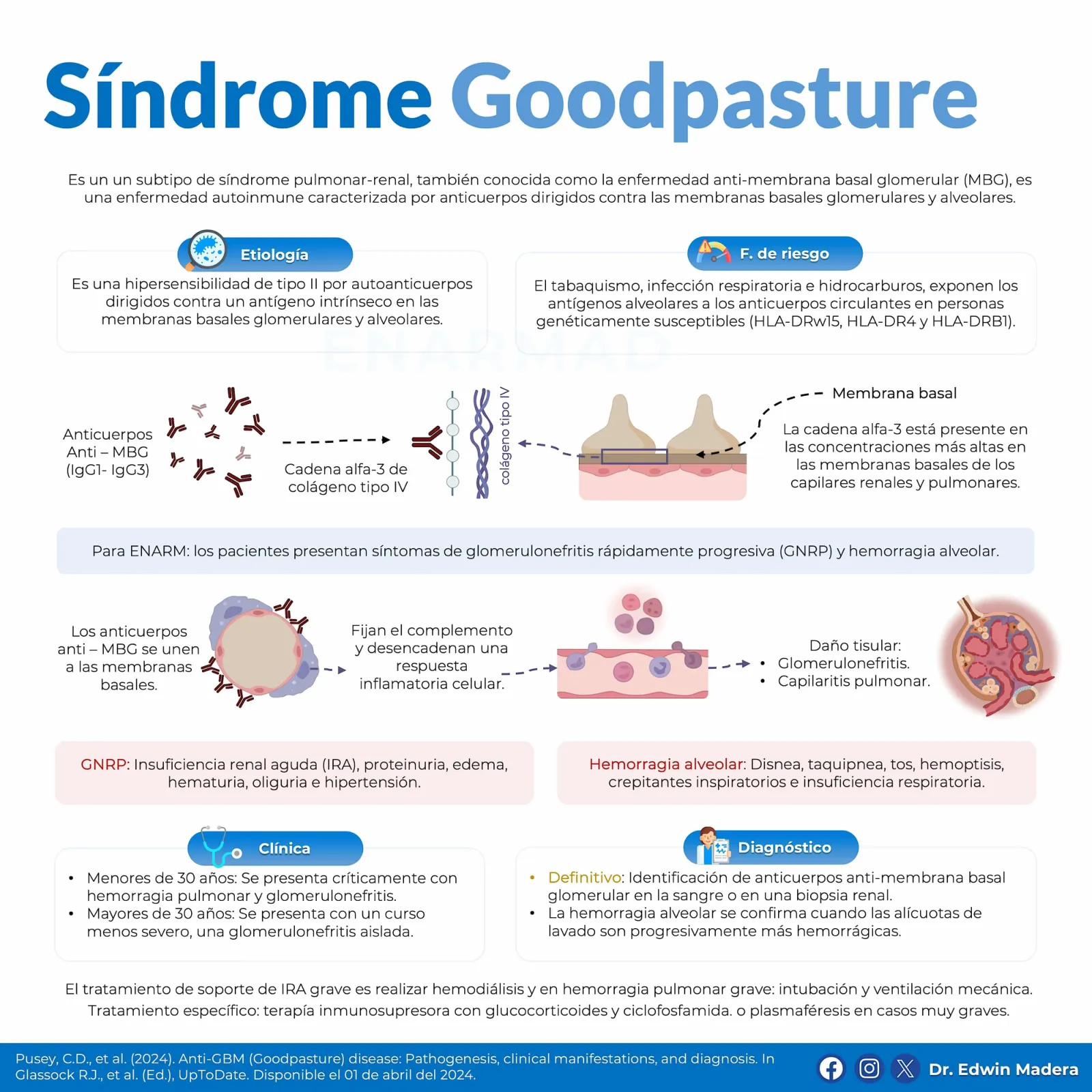 Síndrome de Goodpasture