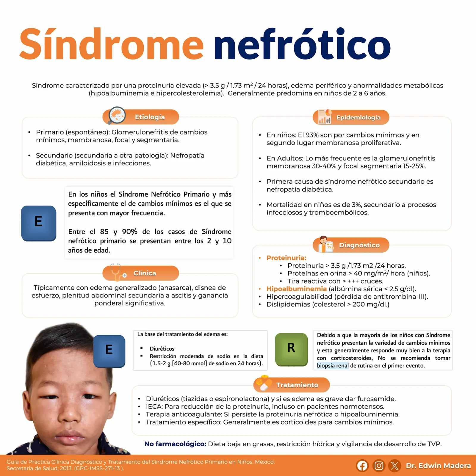 Síndrome nefrótico