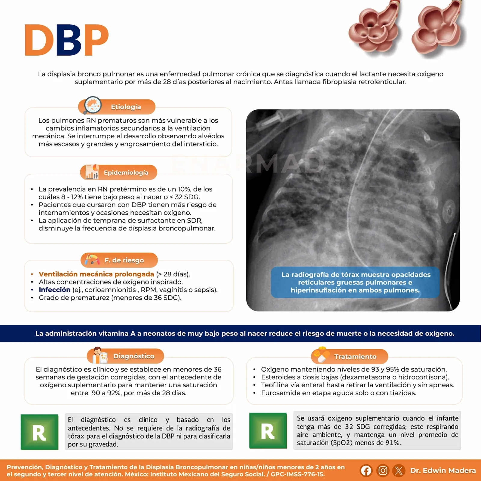 Displasia broncopulmonar