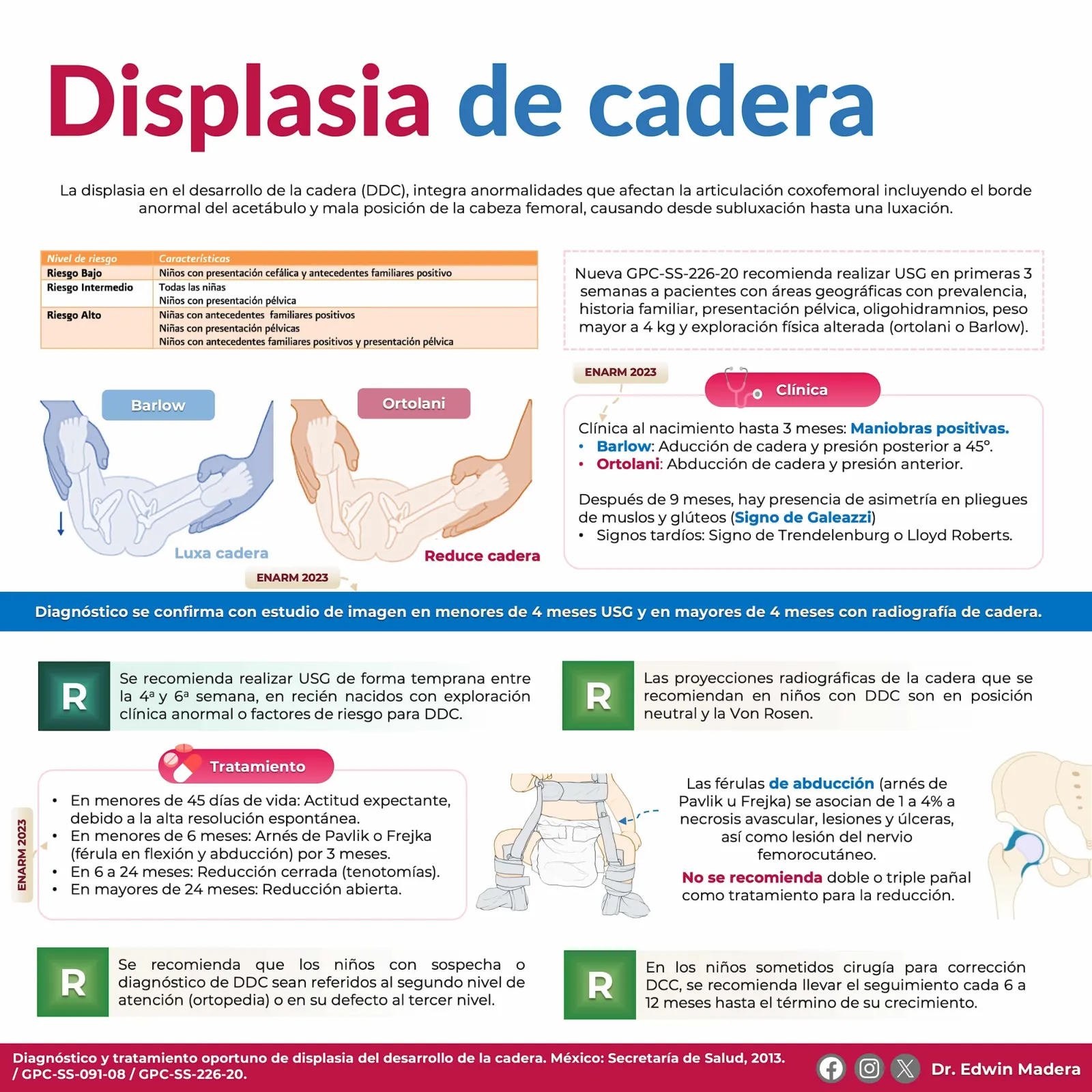 Displasia del desarrollo de la cadera DDC