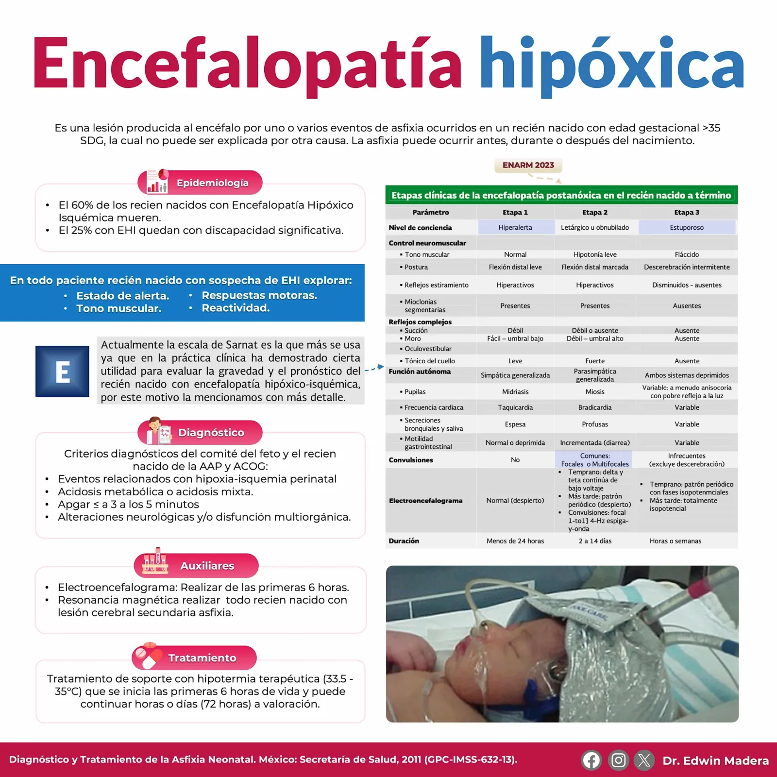 Encefalopatá hipóxica