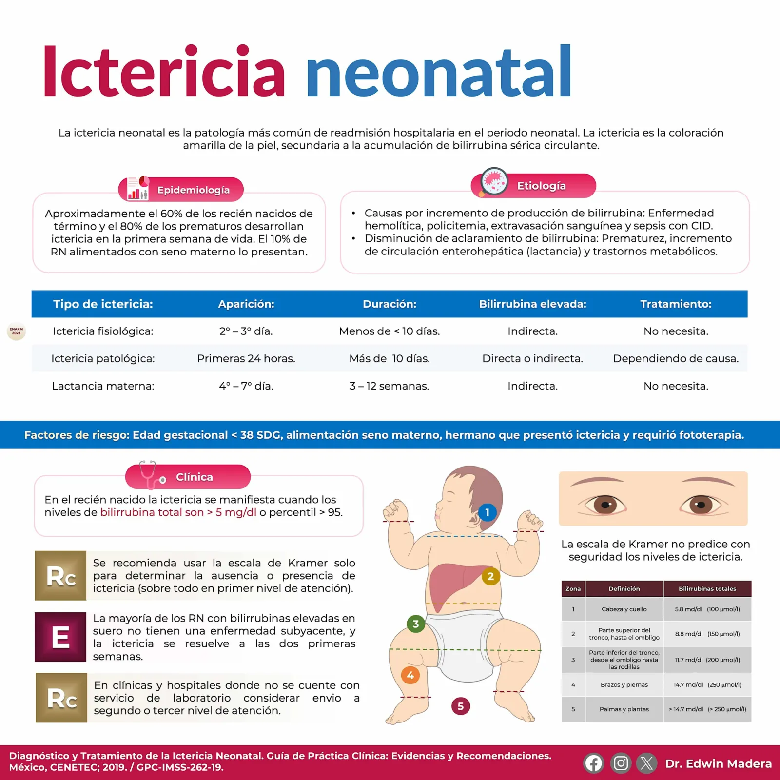Ictericia neonatal