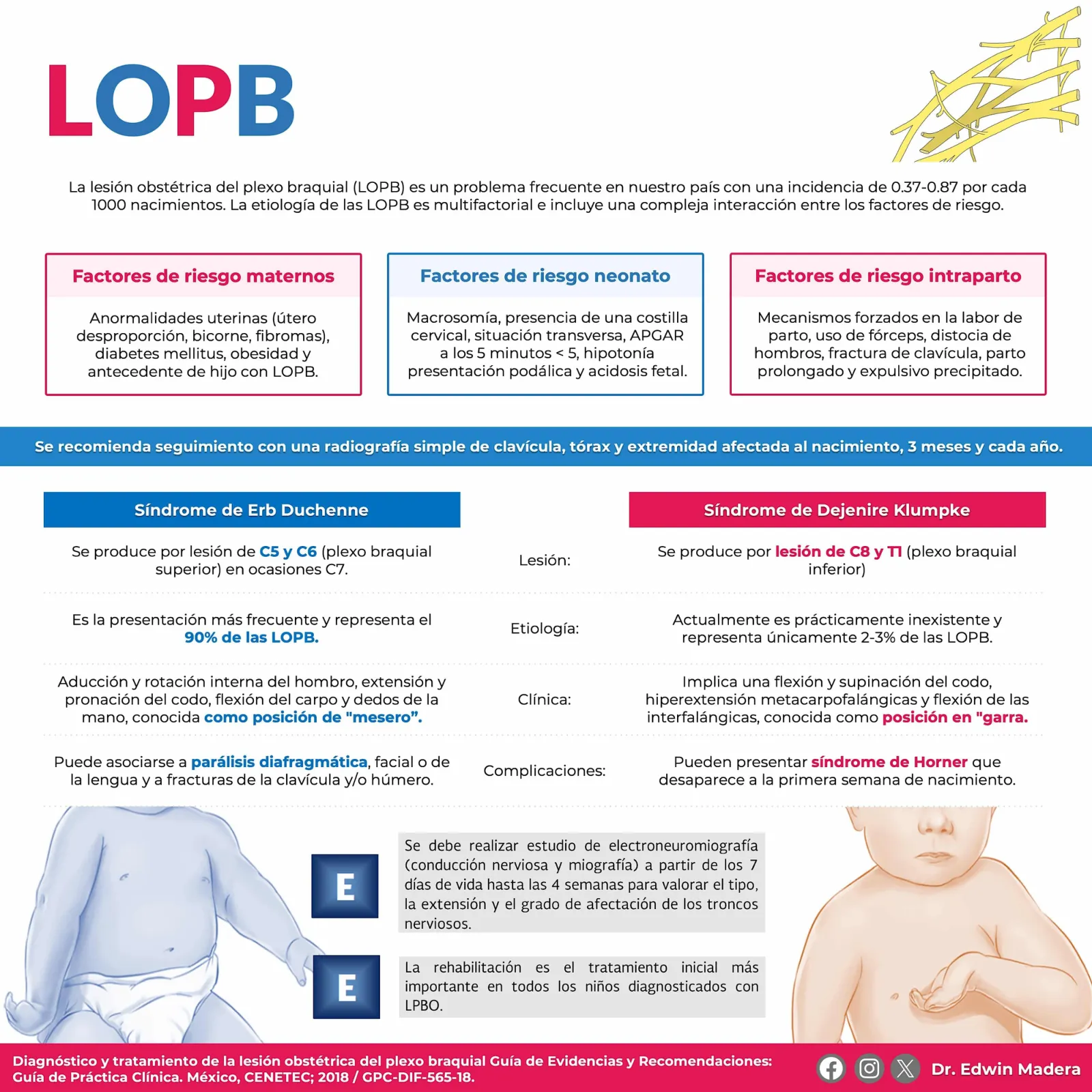 Lesiones de plexo baquial obstétrico
