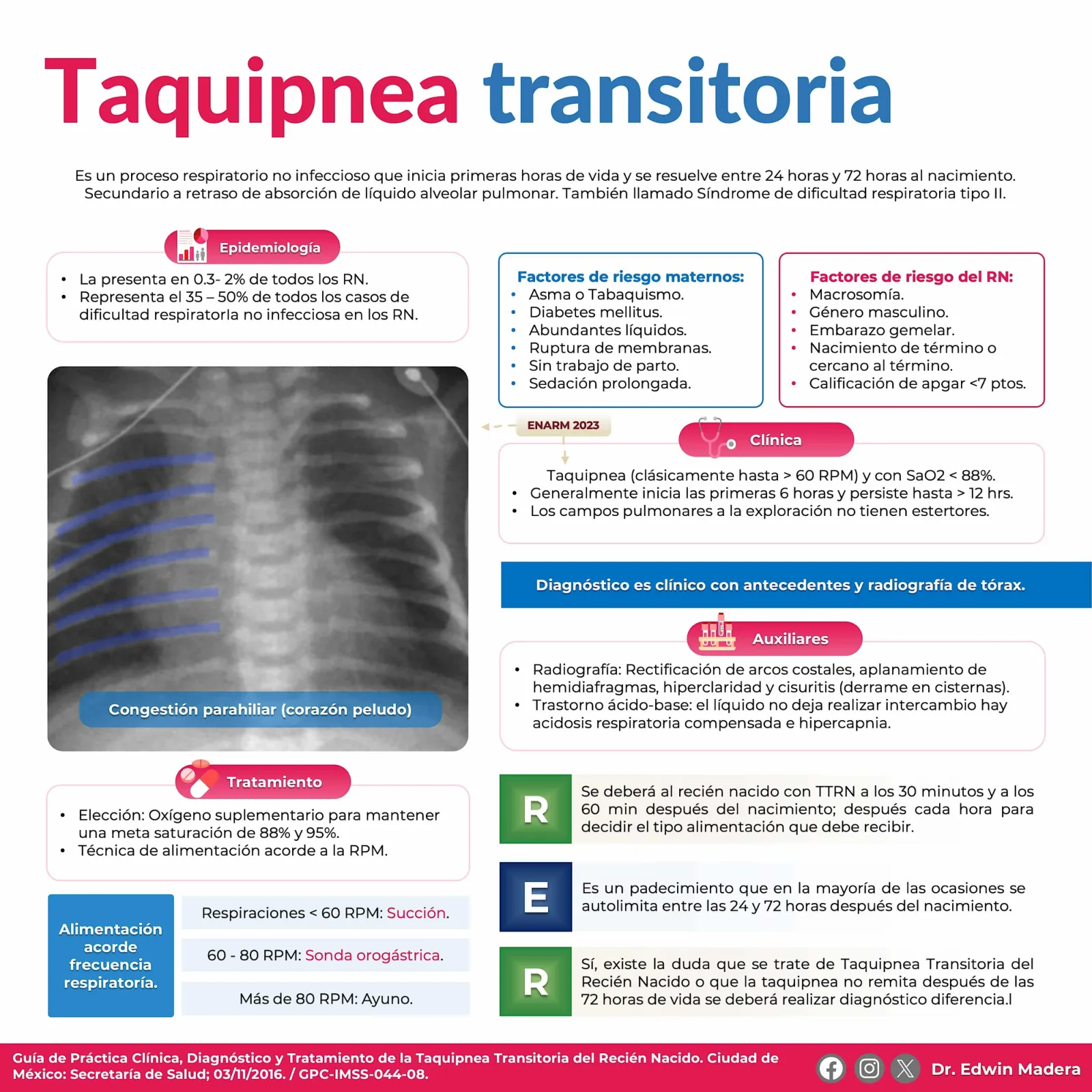Taquipnea transitoria del recien nacido
