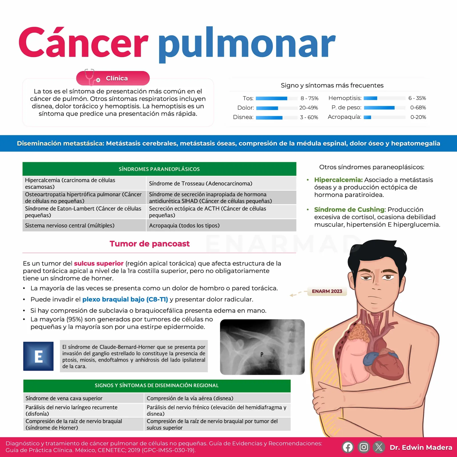 Cáncer de pulmón