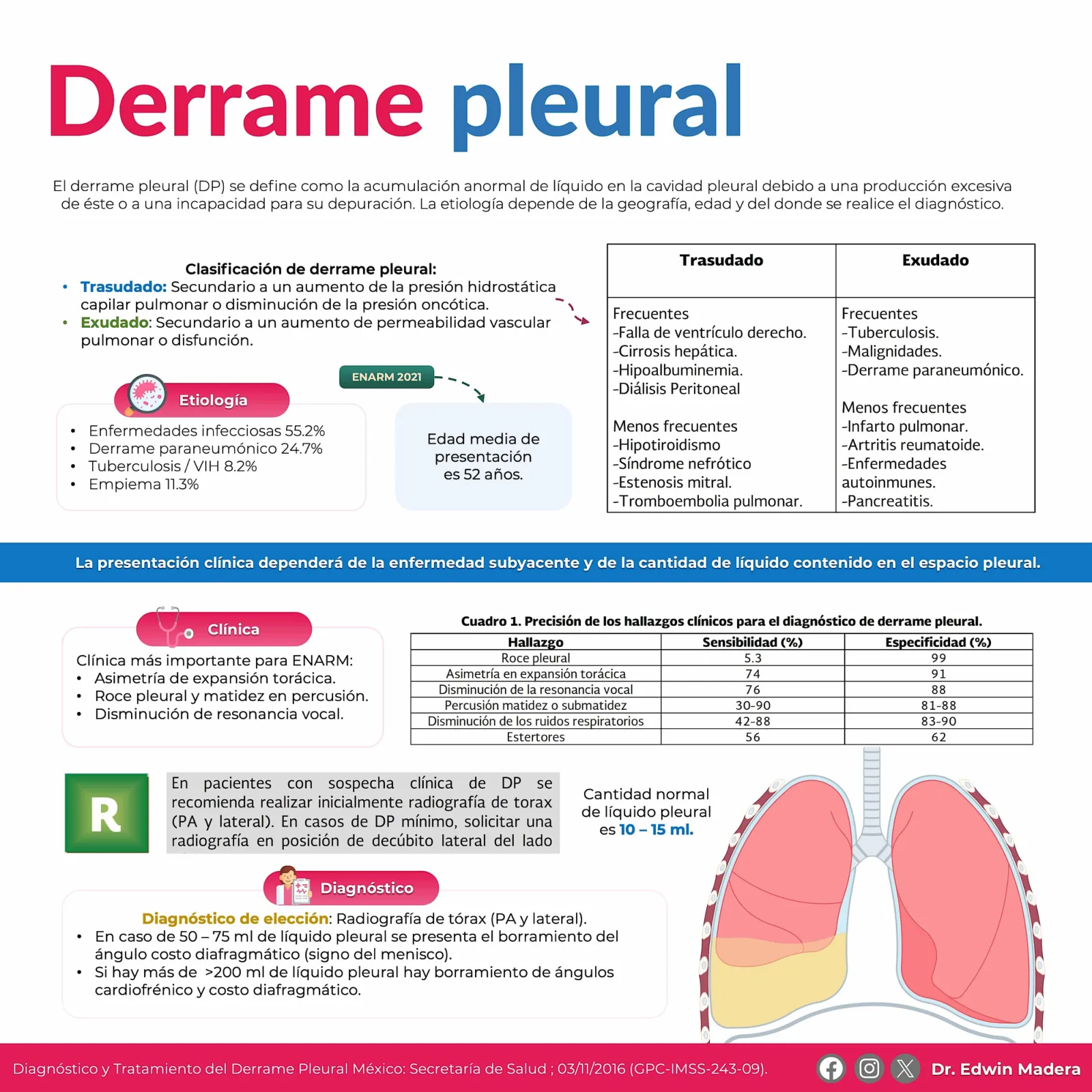 Derrame pleural