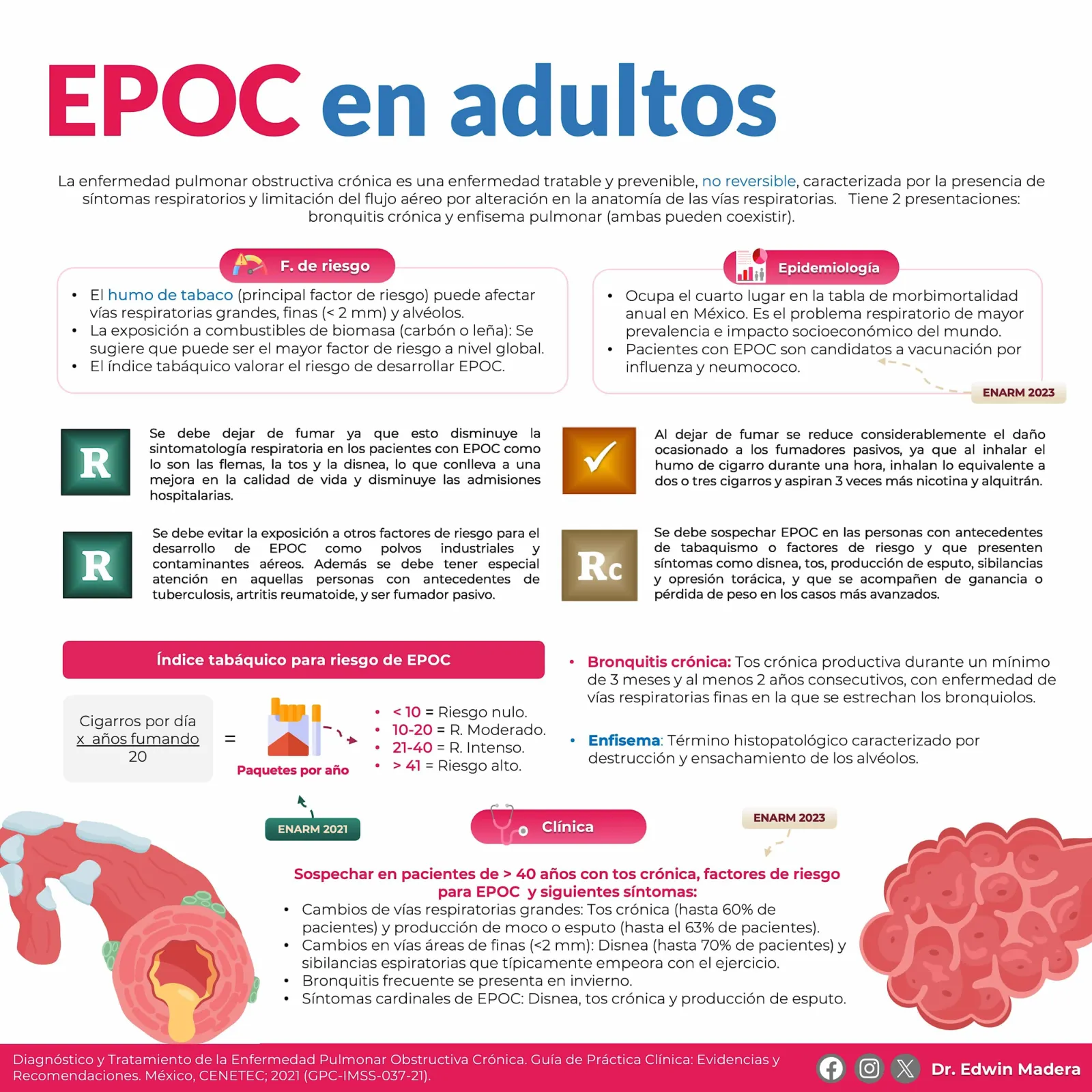 EPOC