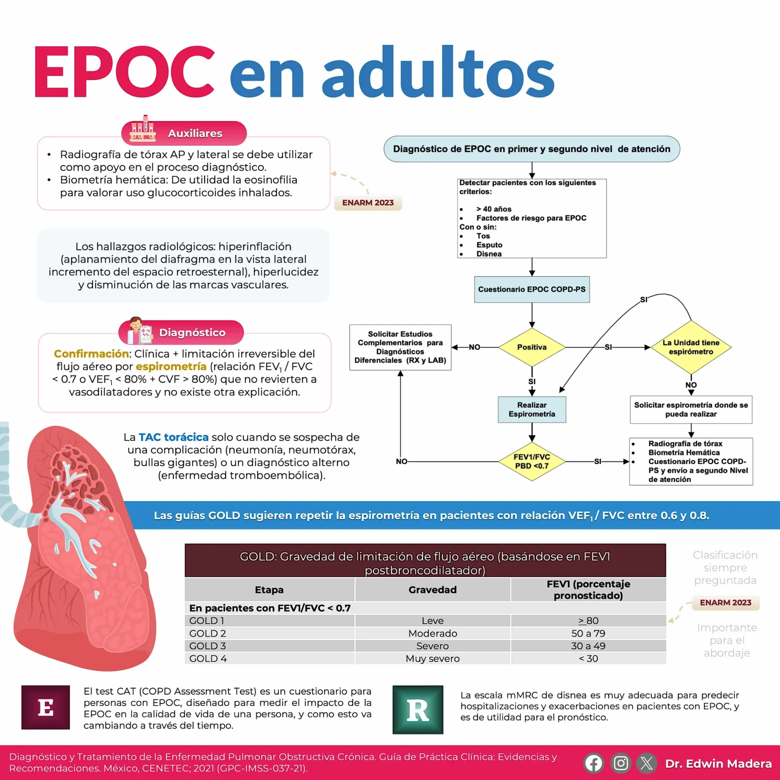 EPOC