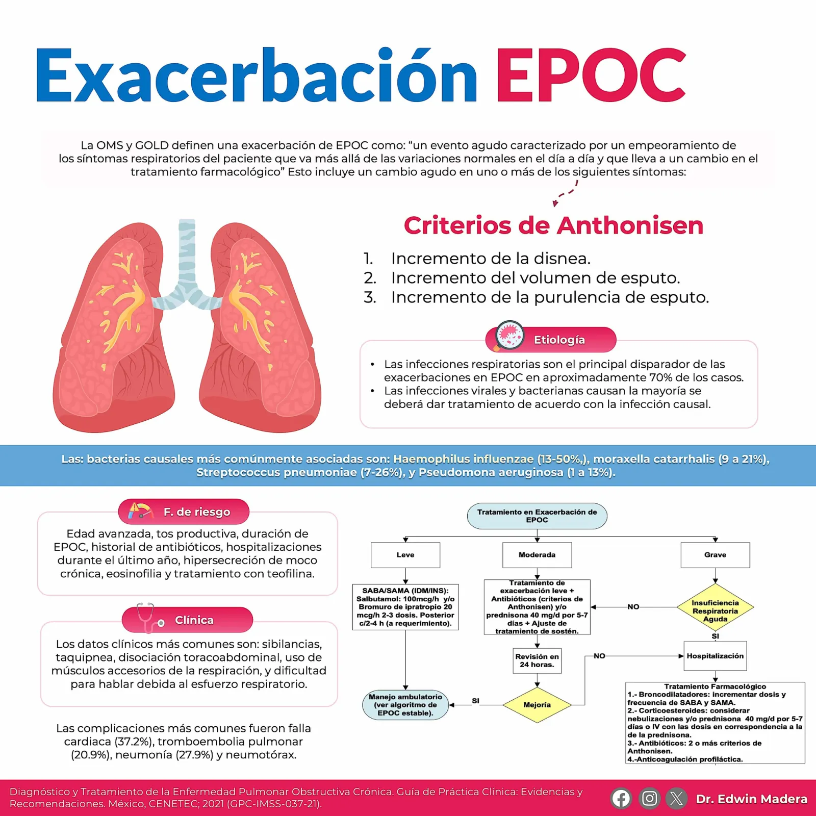 EPOC
