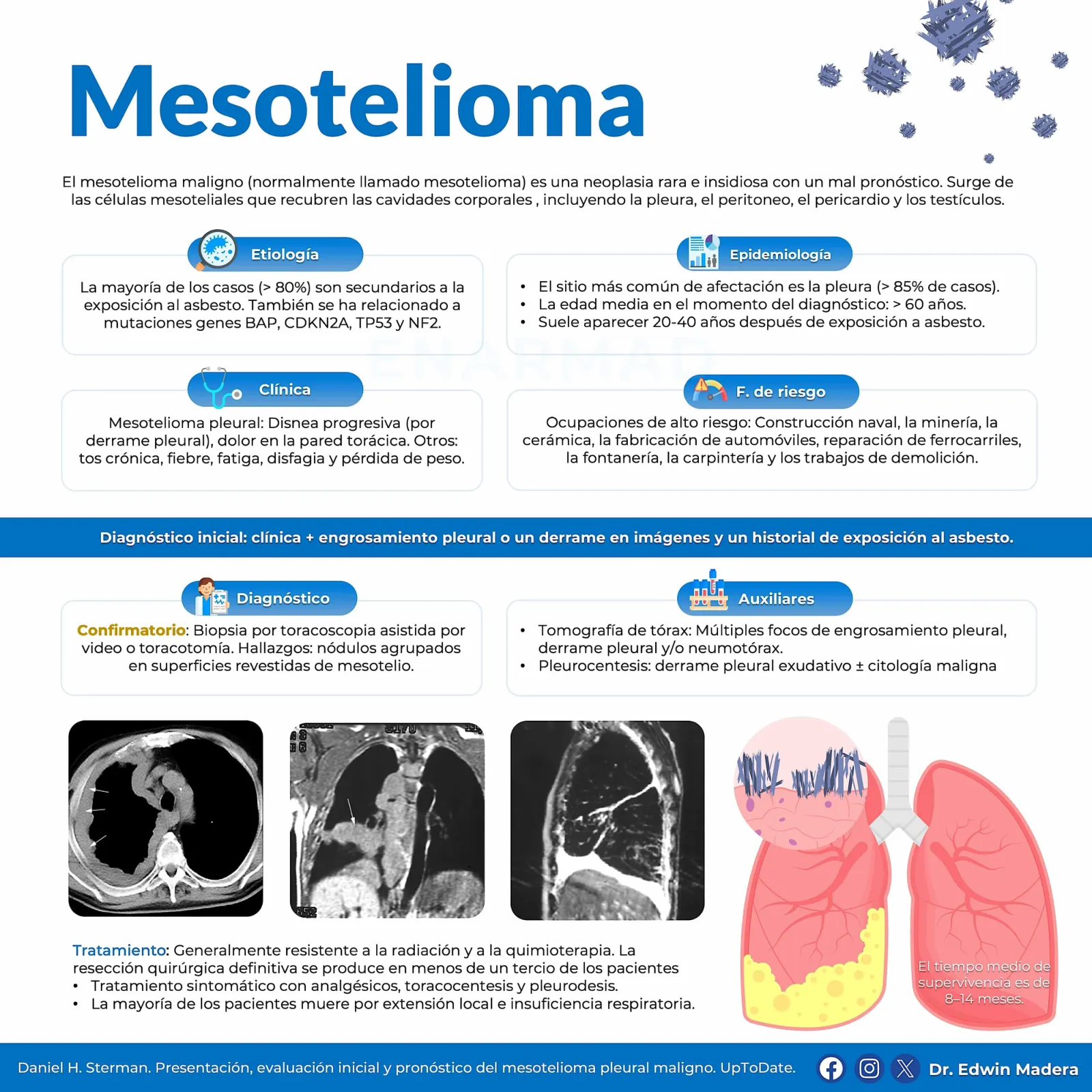 Mesotelioma