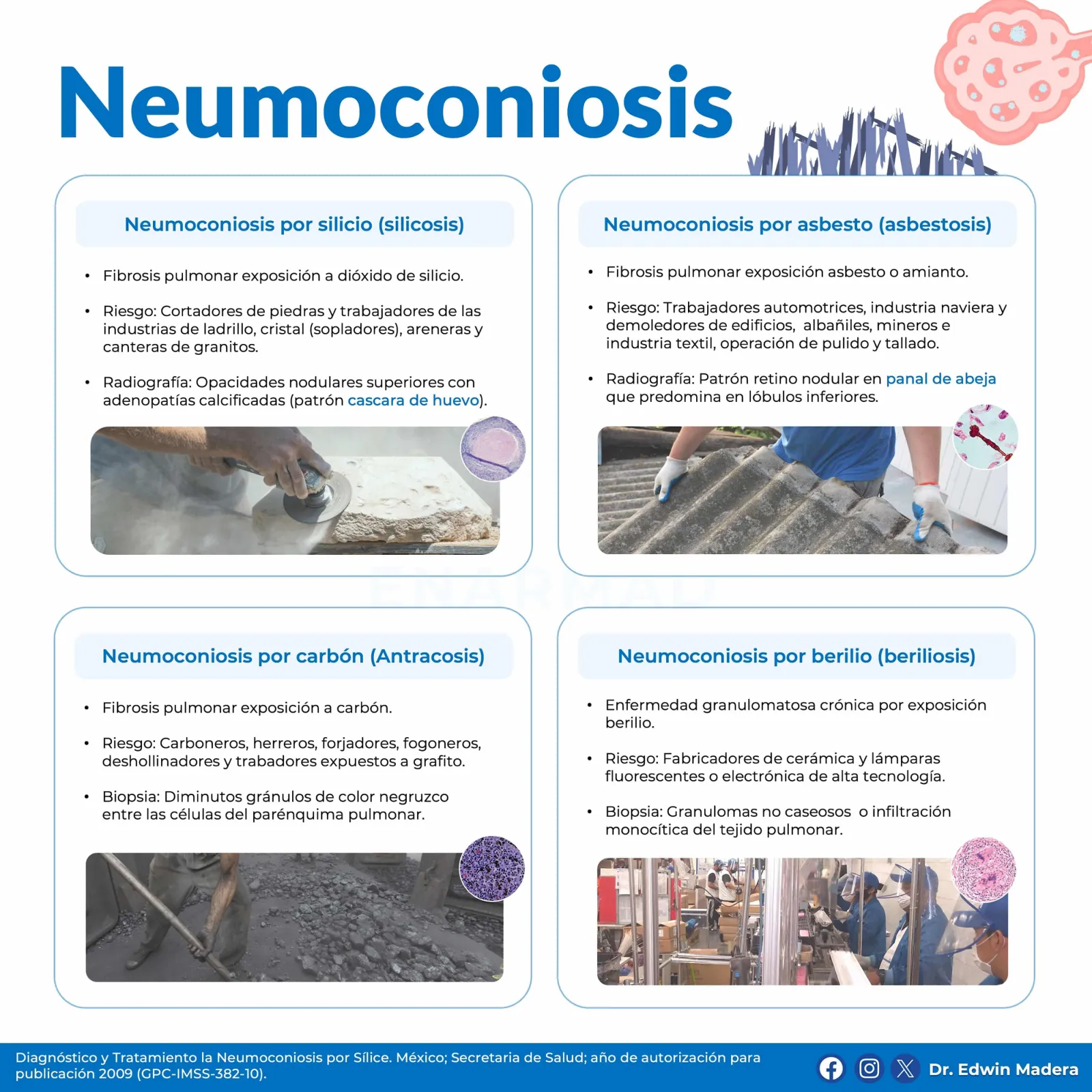 Neumoconiosis
