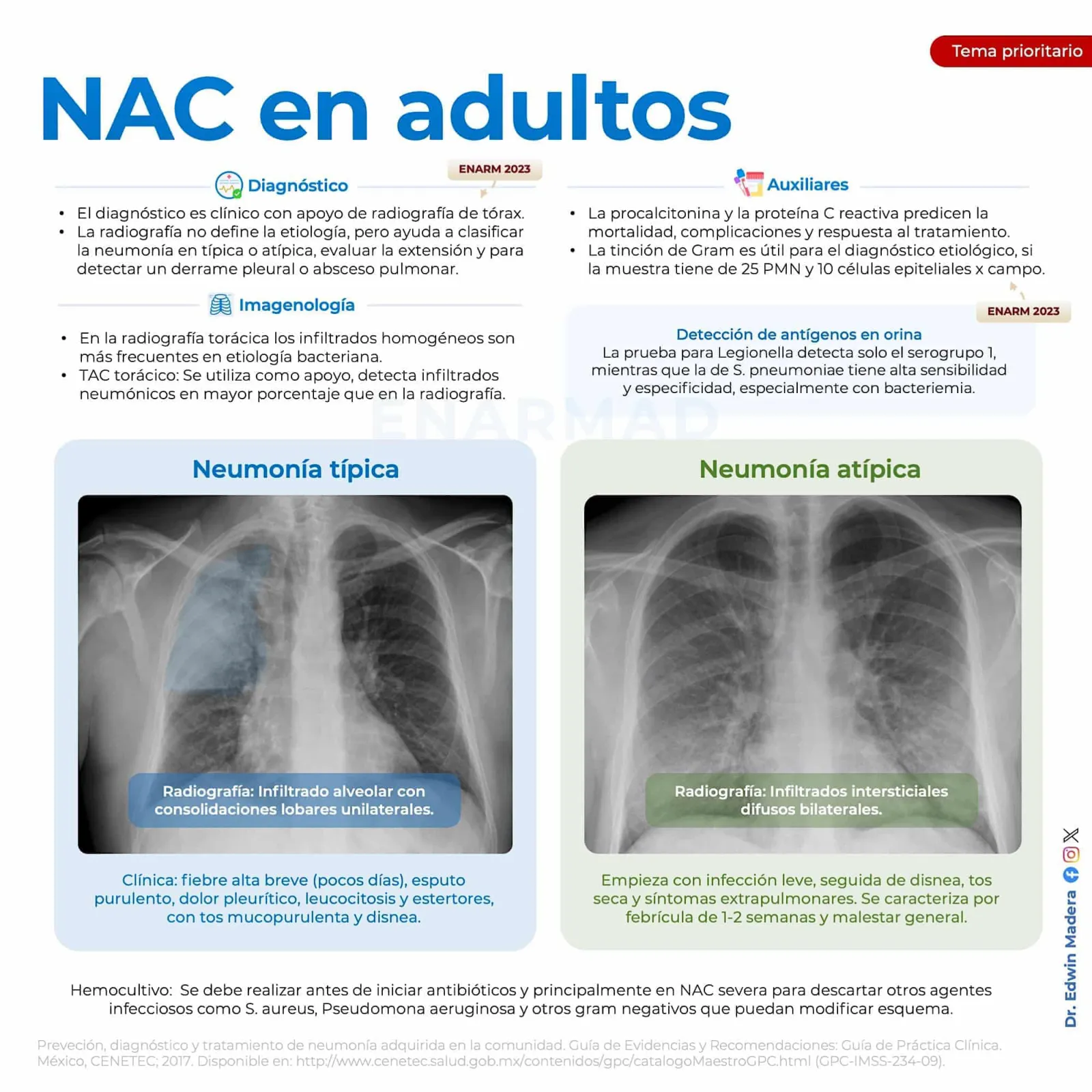 Neumonía adquirida en la comunidad