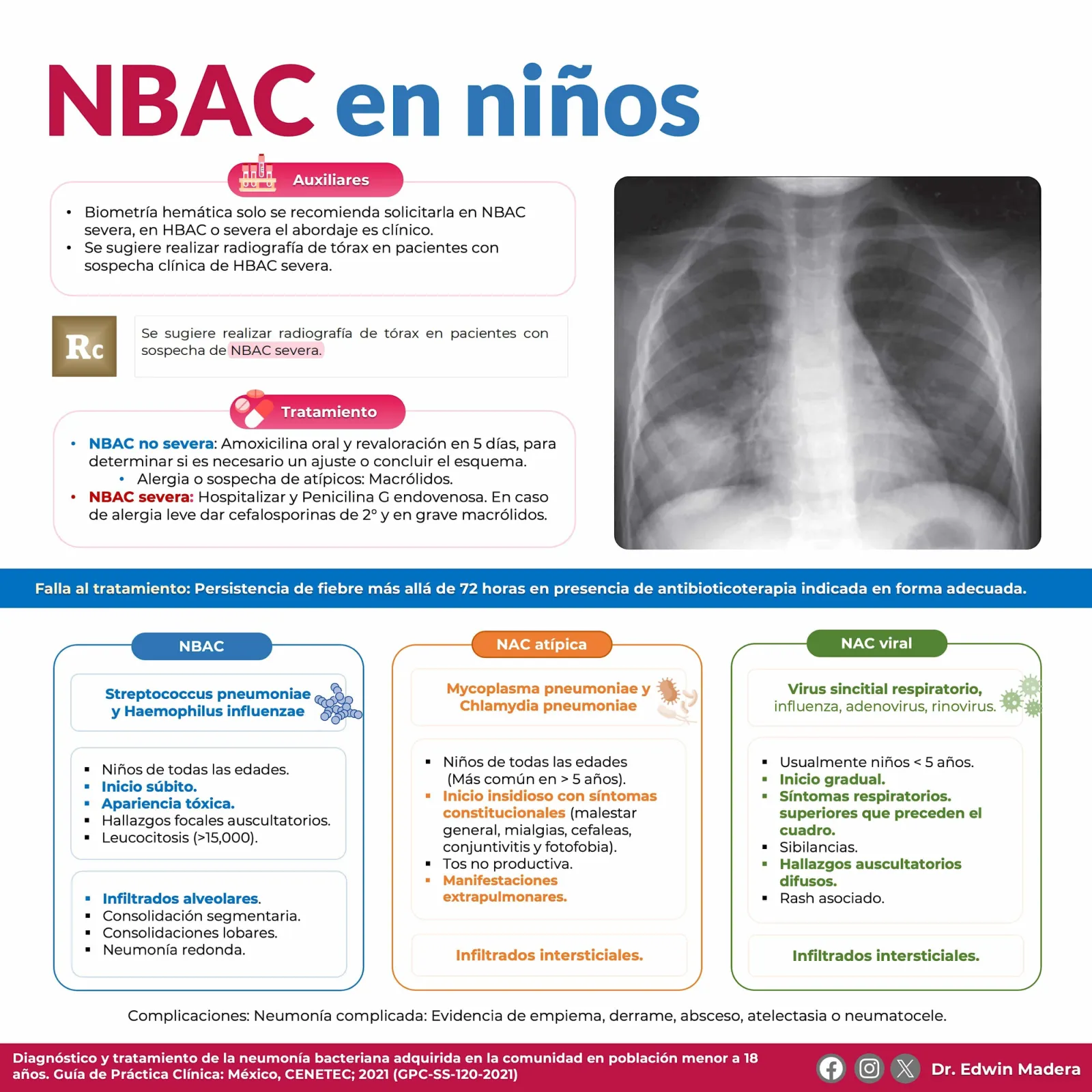 Neumonía bacteriana adquirida en la comunidad Niños