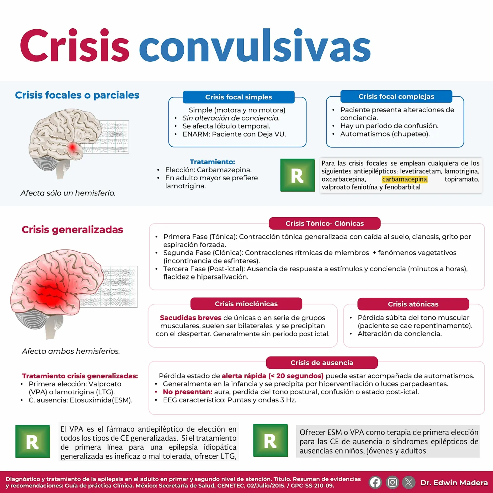 Crisis convulsivas