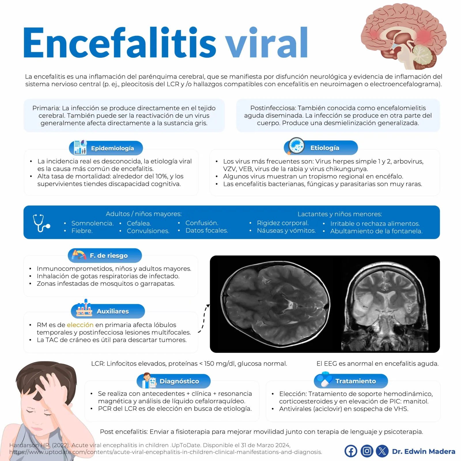 Encefalitis viral
